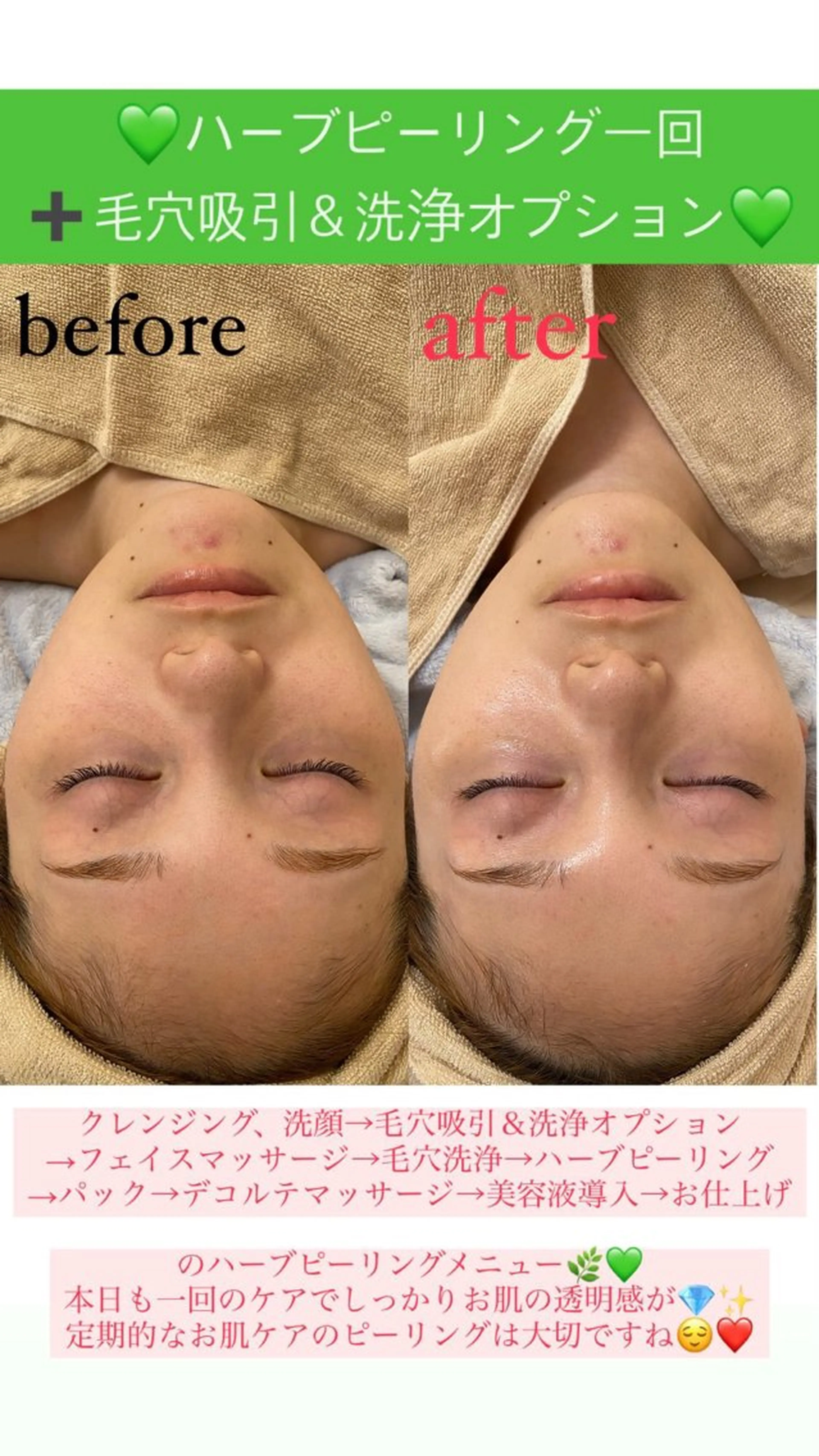 メンズ エステ Salon de Lino 御器所のエステ・リラクイメージ