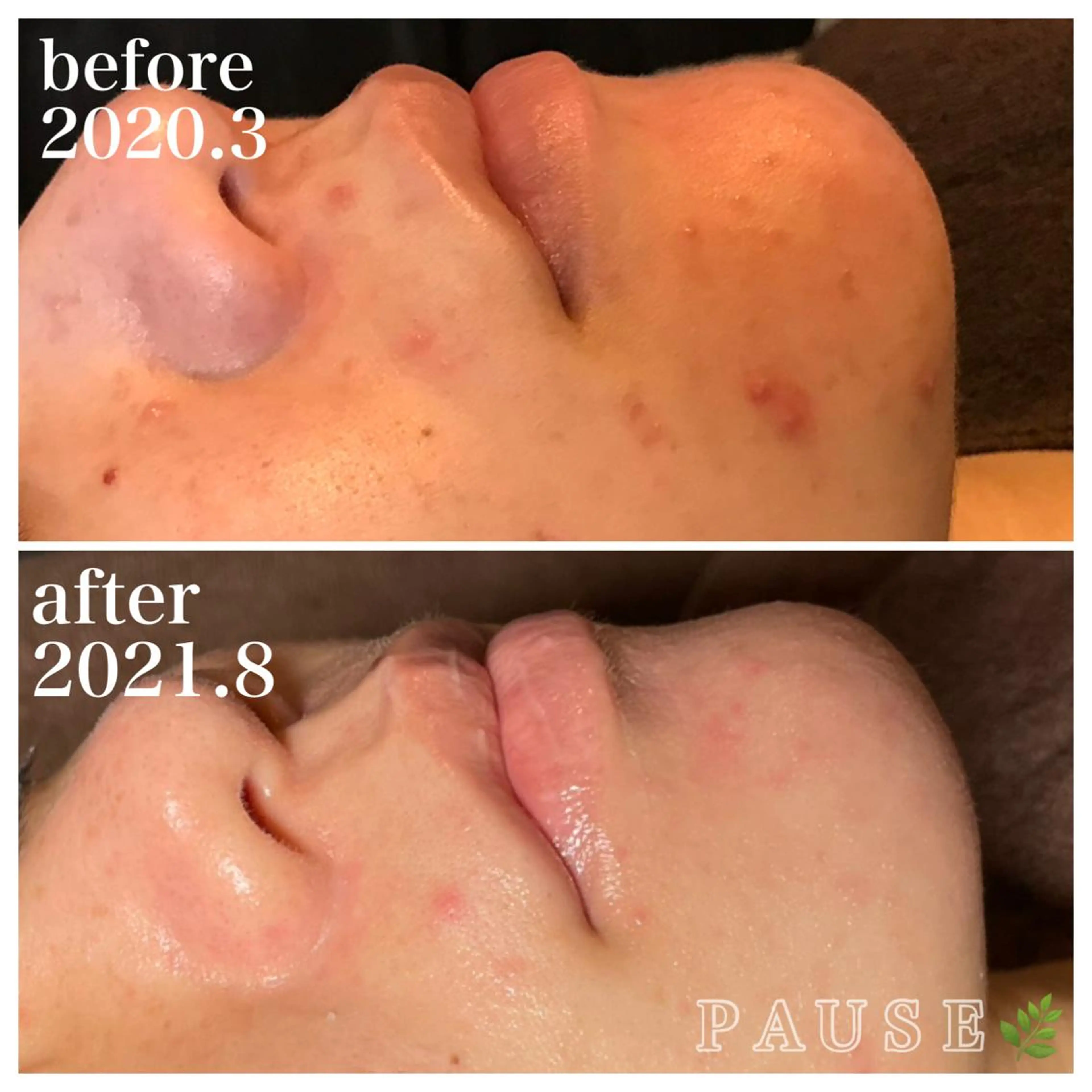 エステ 浜野 恵美のエステ・リラクイメージ