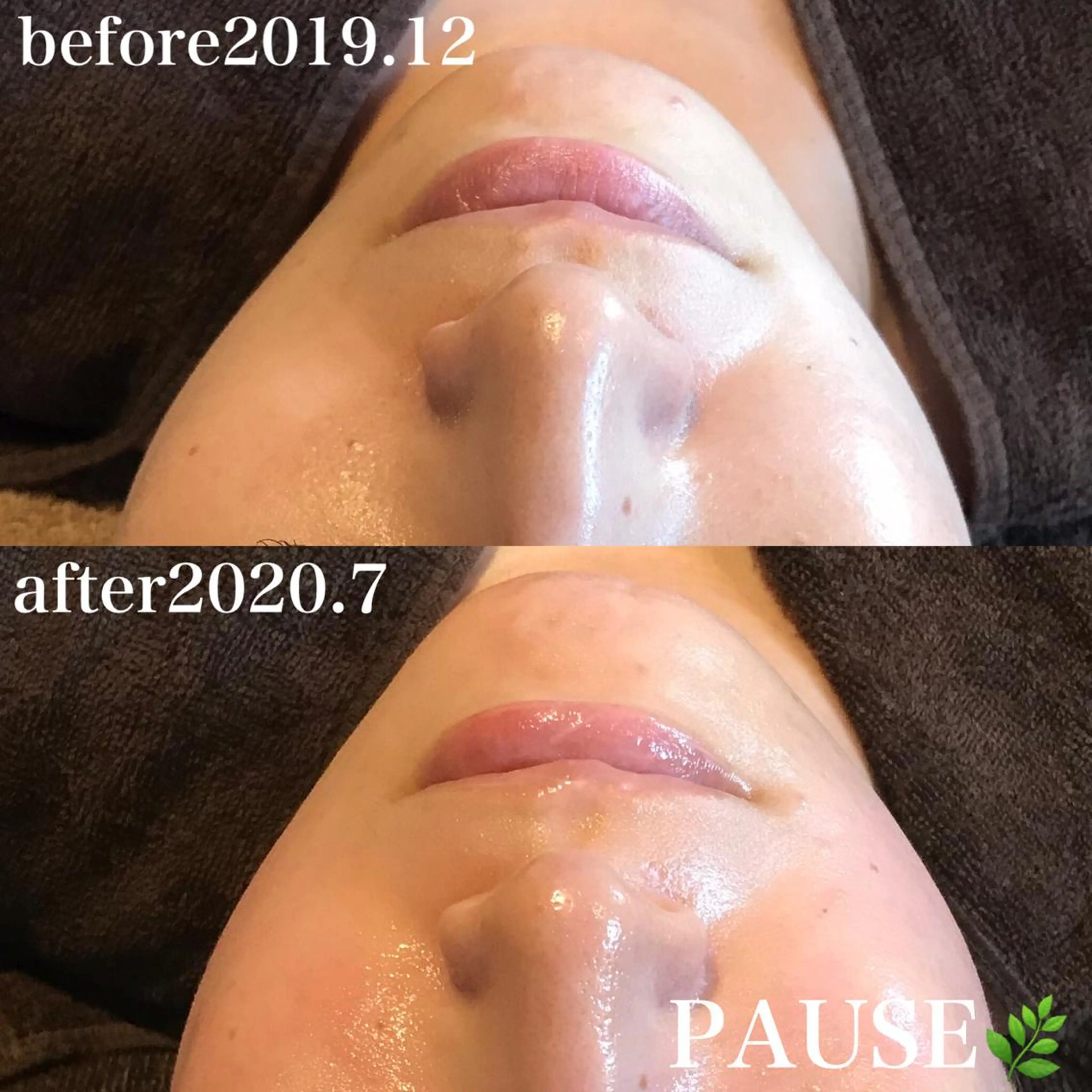 エステ 浜野 恵美のエステ・リラクイメージ