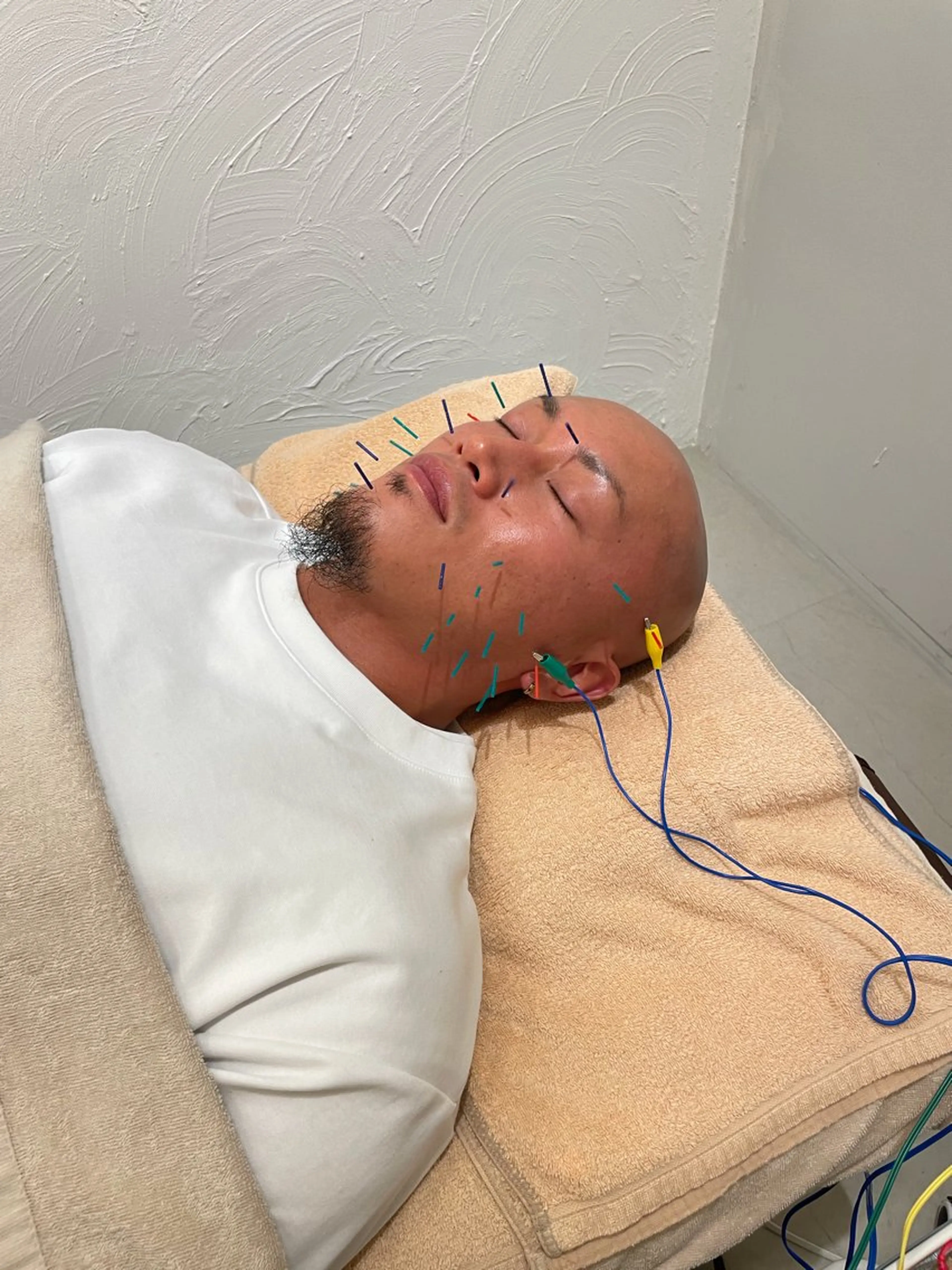 メンズ 🌸美容鍼サロン🌸 メゾンブランシェ🌈のエステ・リラクイメージ