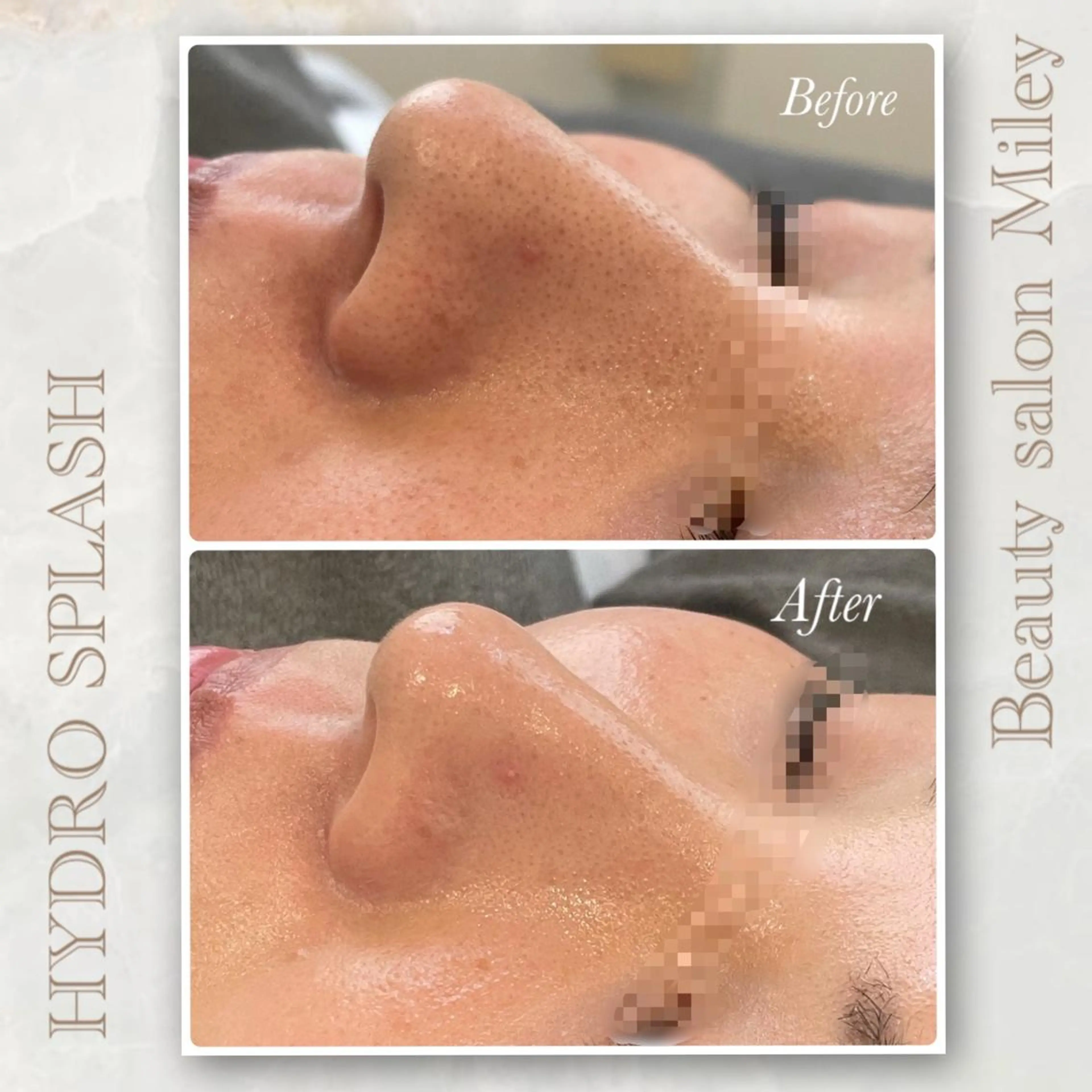 エステ Miley/肌質改善 Megumiのエステ・リラクイメージ