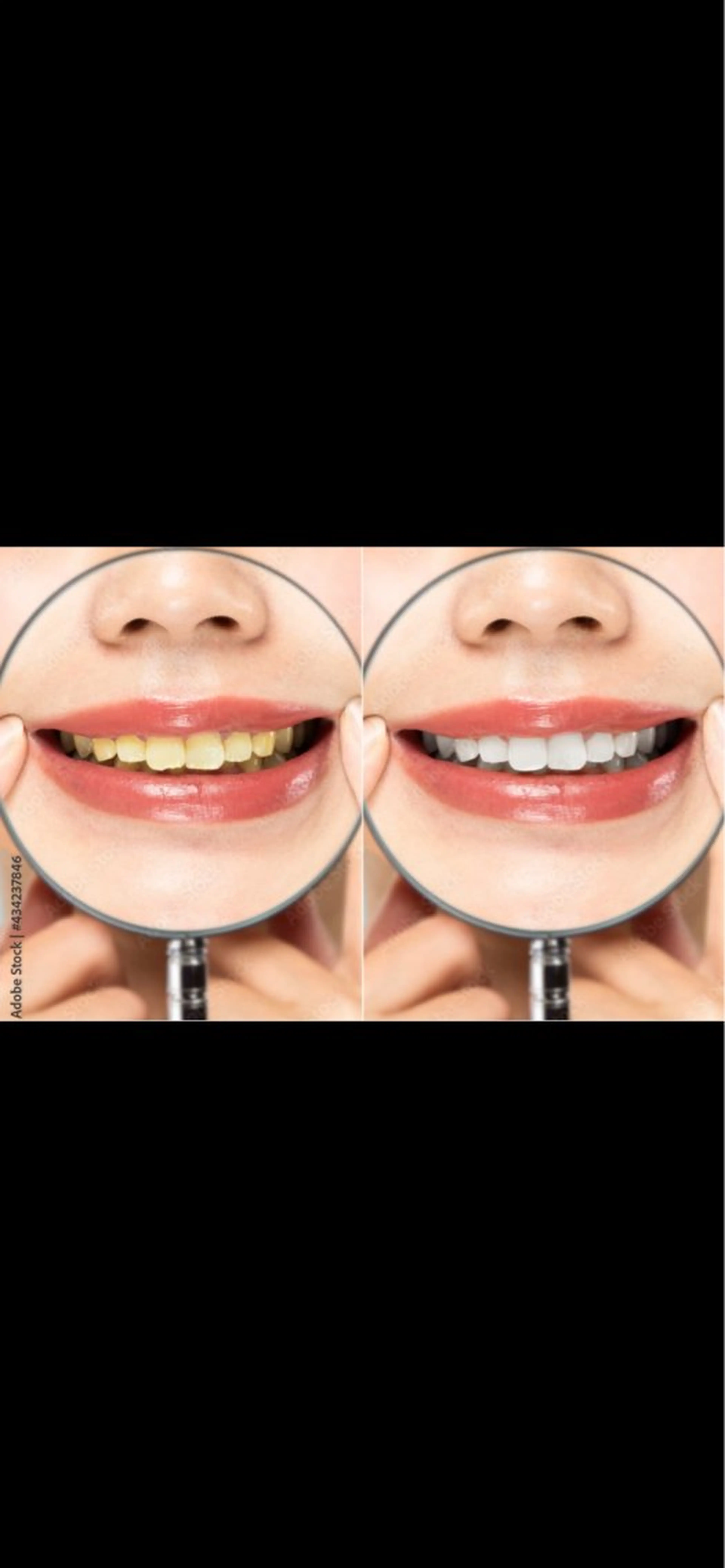 WHITENING ハウスのマツエク・マツパデザイン