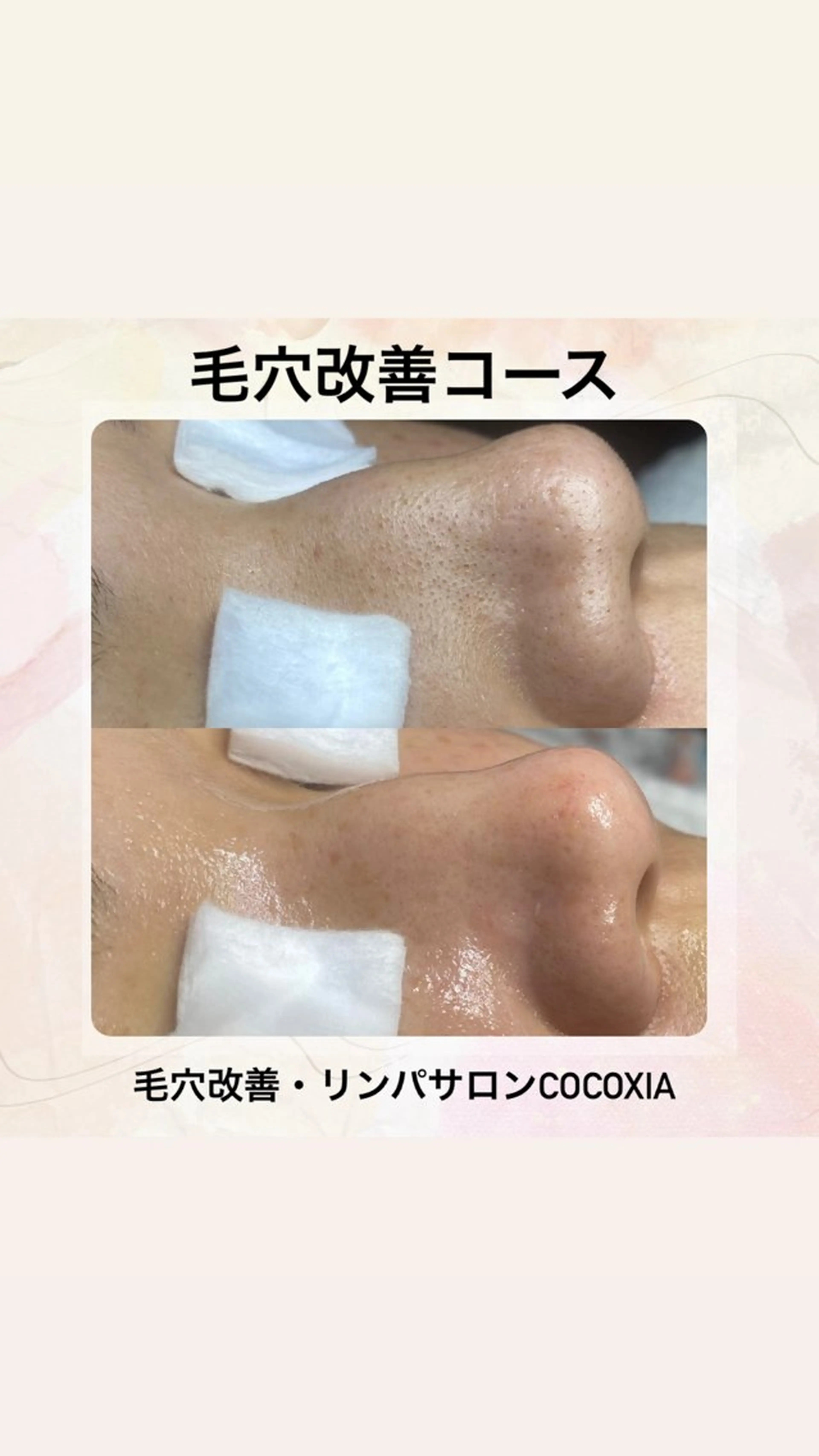 エステ リラク 肌改善・リンパサロン CoCoxiaのエステ・リラクイメージ