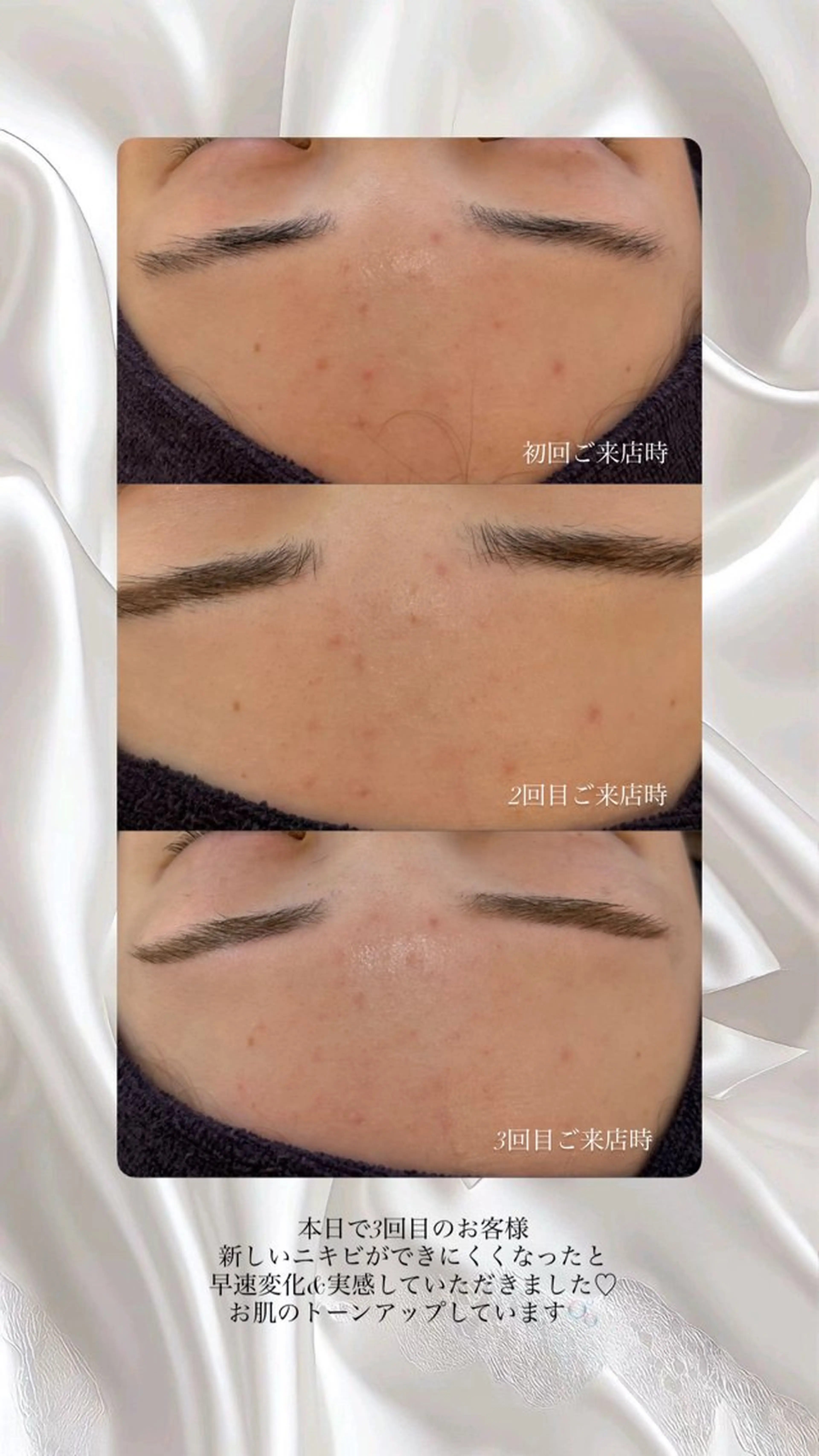 エステ yukiko/美容師 肌質改善/中崎町のエステ・リラクイメージ