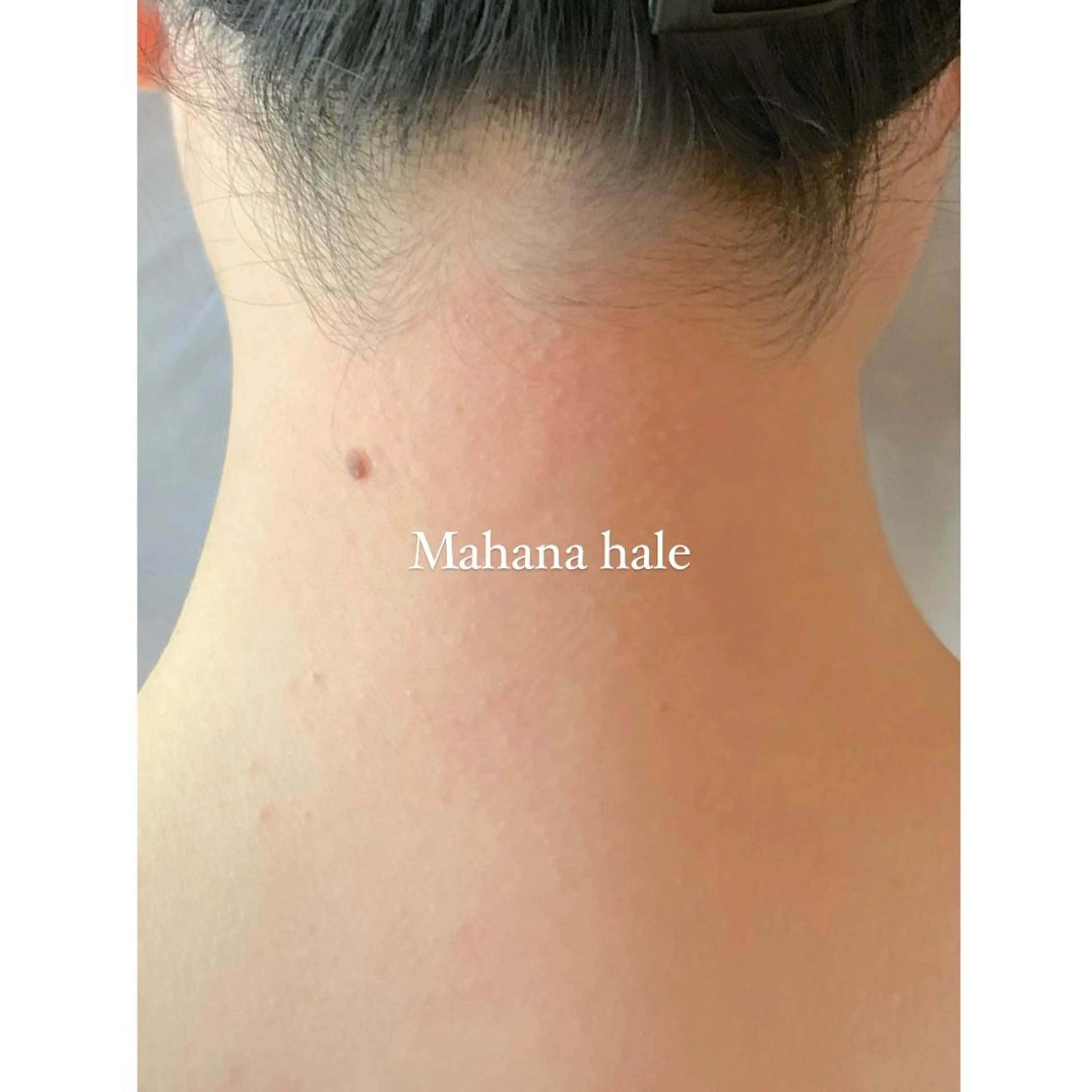 脱毛 Mahana haleのエステ・リラクイメージ