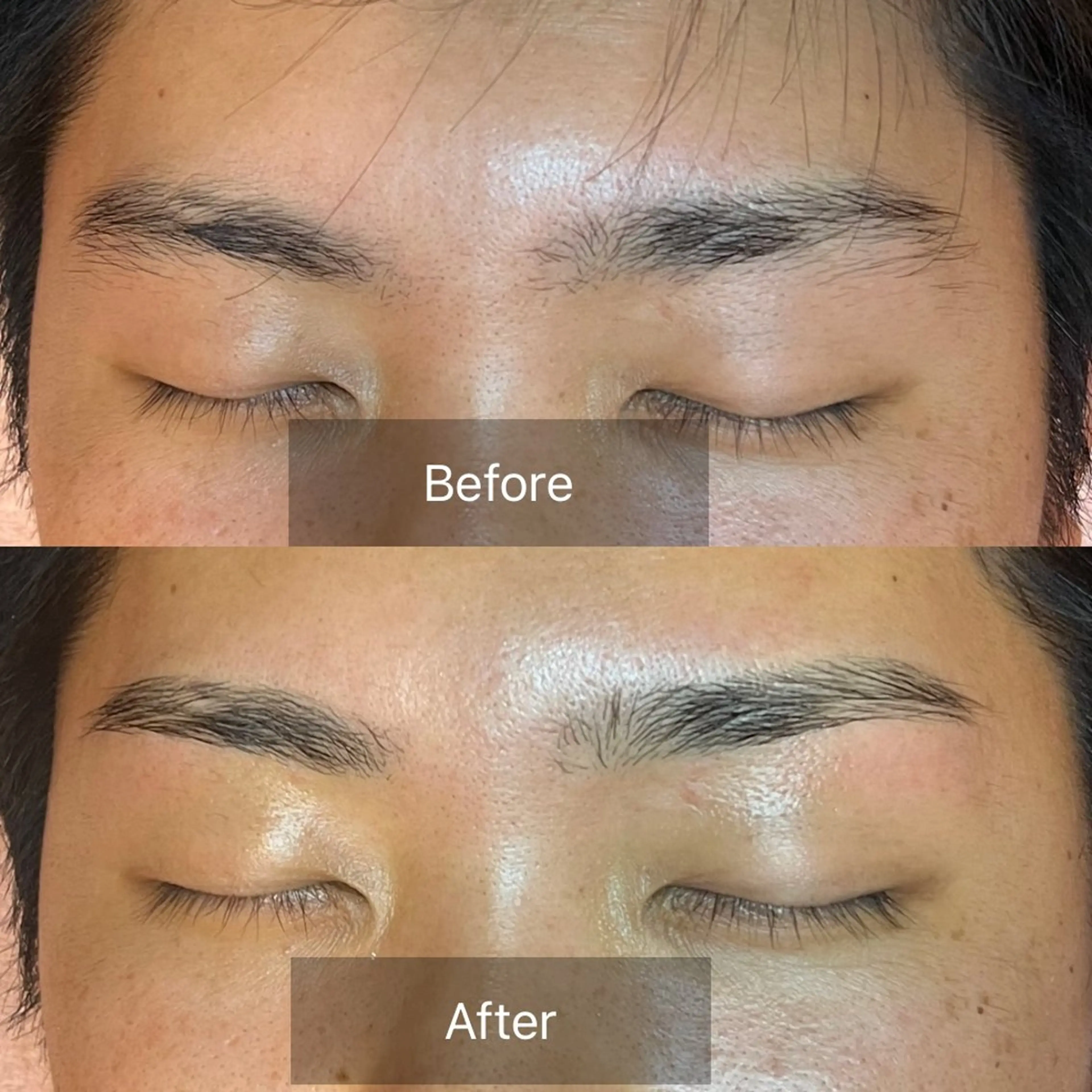 メンズ眉毛+Wax脱毛の写真