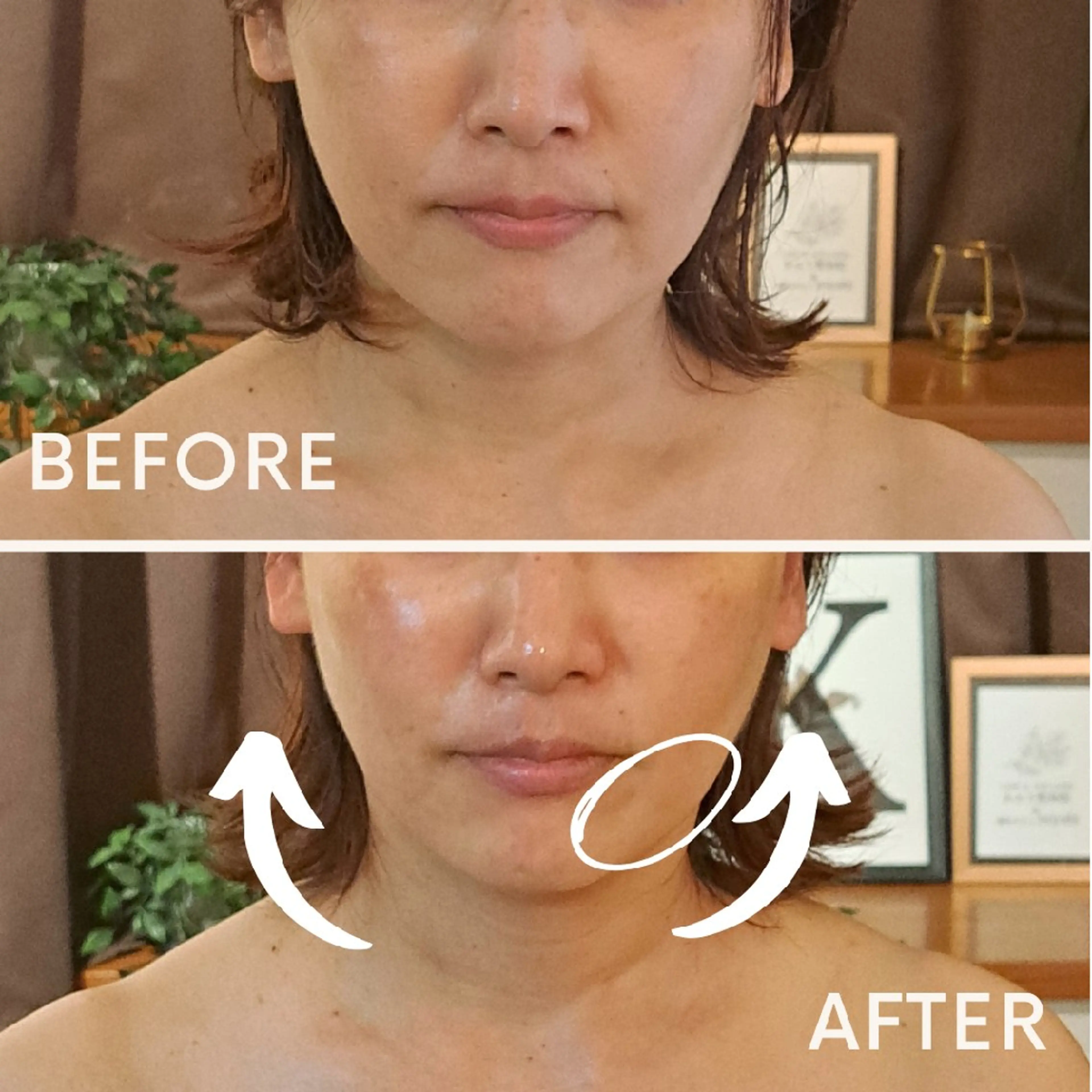 エステ リラク 鍼灸サロンmiyabi所属・美容鍼×エステ 鍼灸 サロンmiyabiのエステ・リラクイメージ