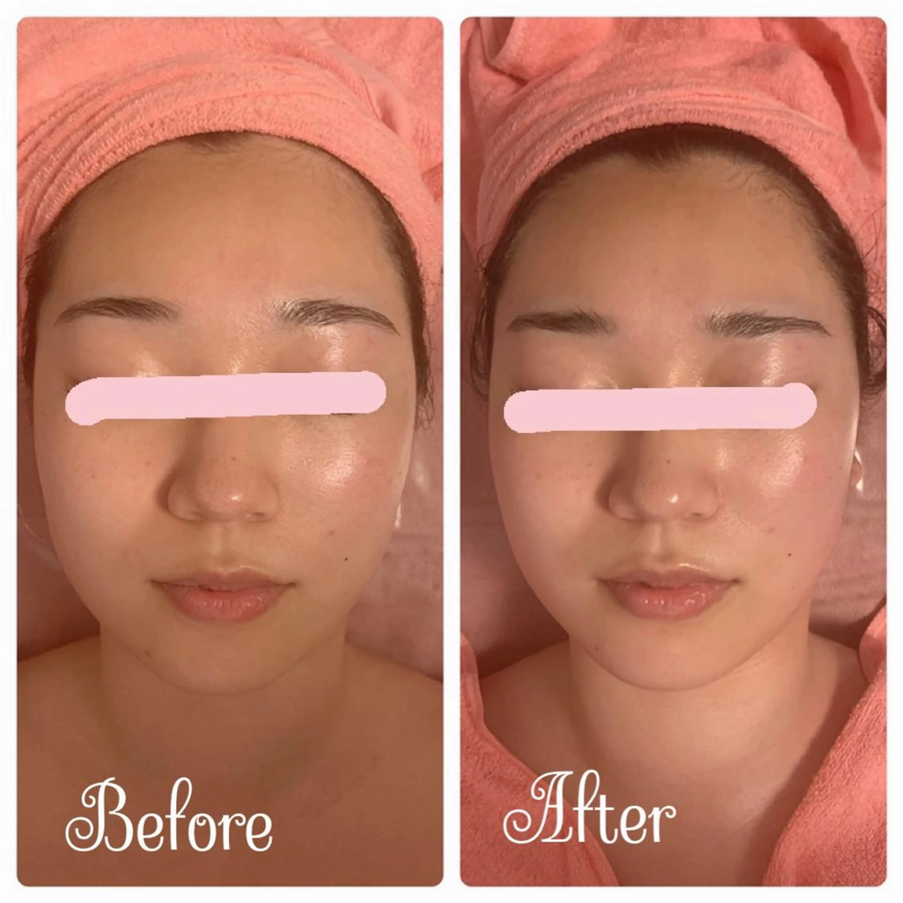 Linomalie エステ/たるみ/脱毛のエステ・リラクイメージ