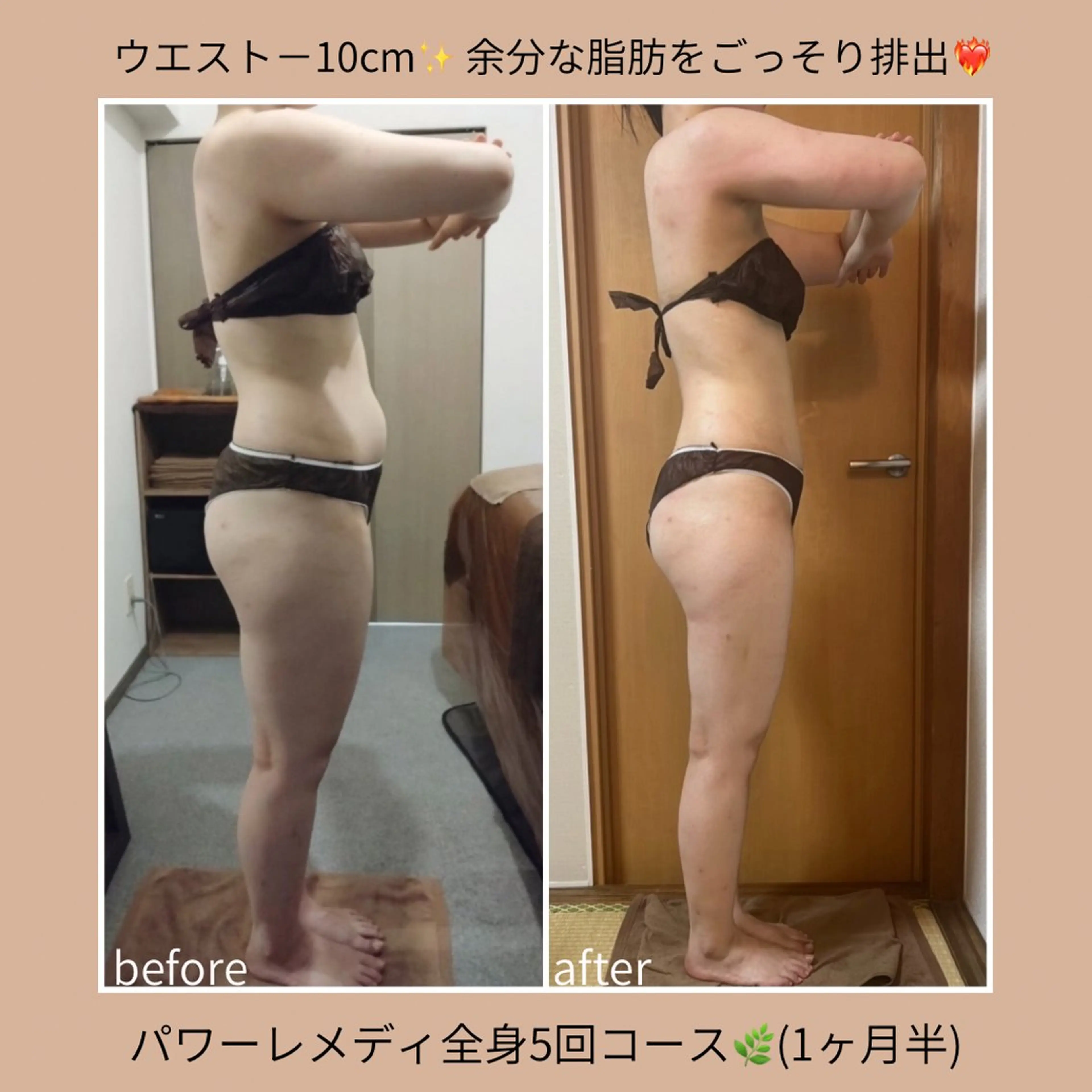 biloop所属・《本気痩せ×疲労改善 》 BILOOPのエステ・リラクイメージ