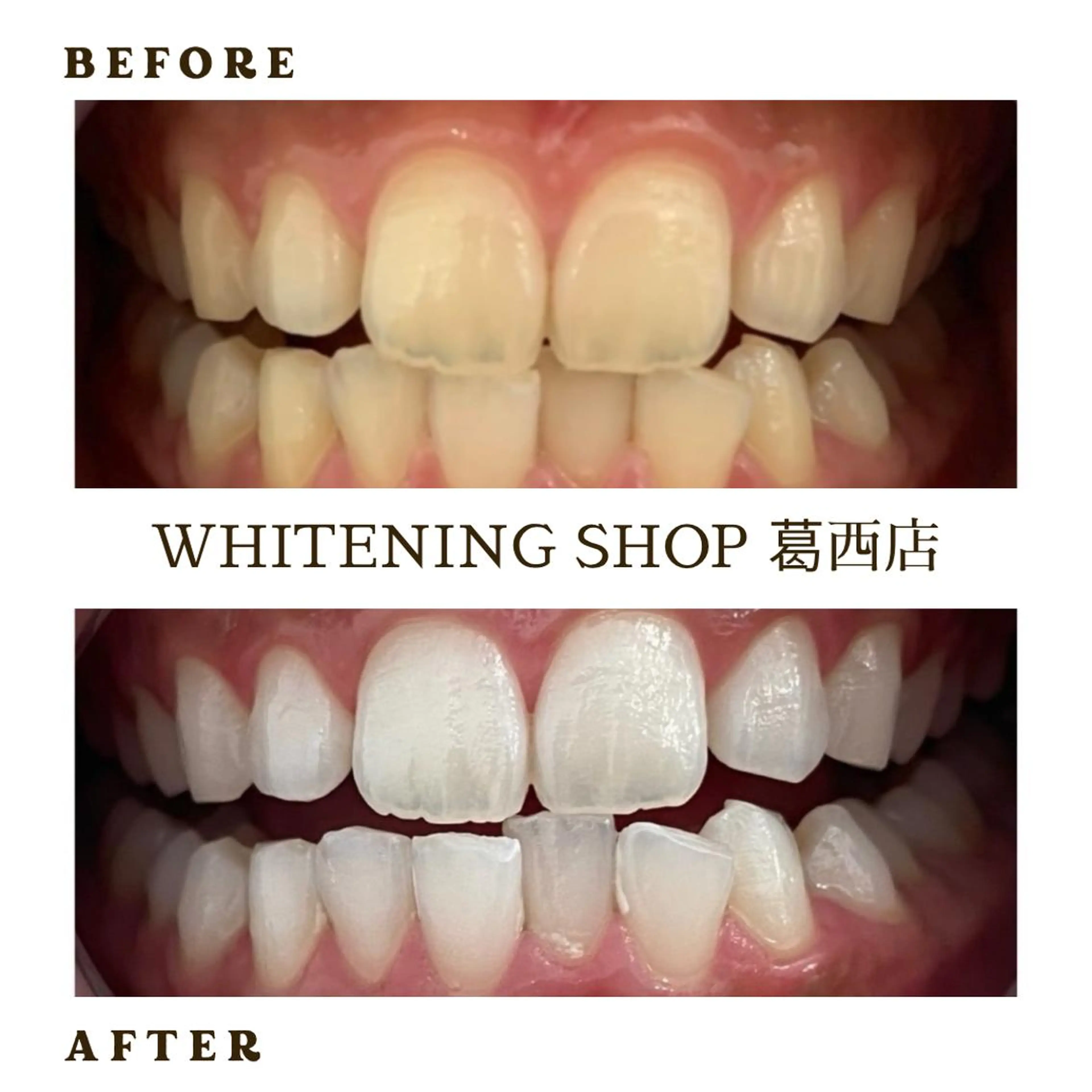 メンズ エステ ホワイトニング ショップ葛西店のその他イメージ