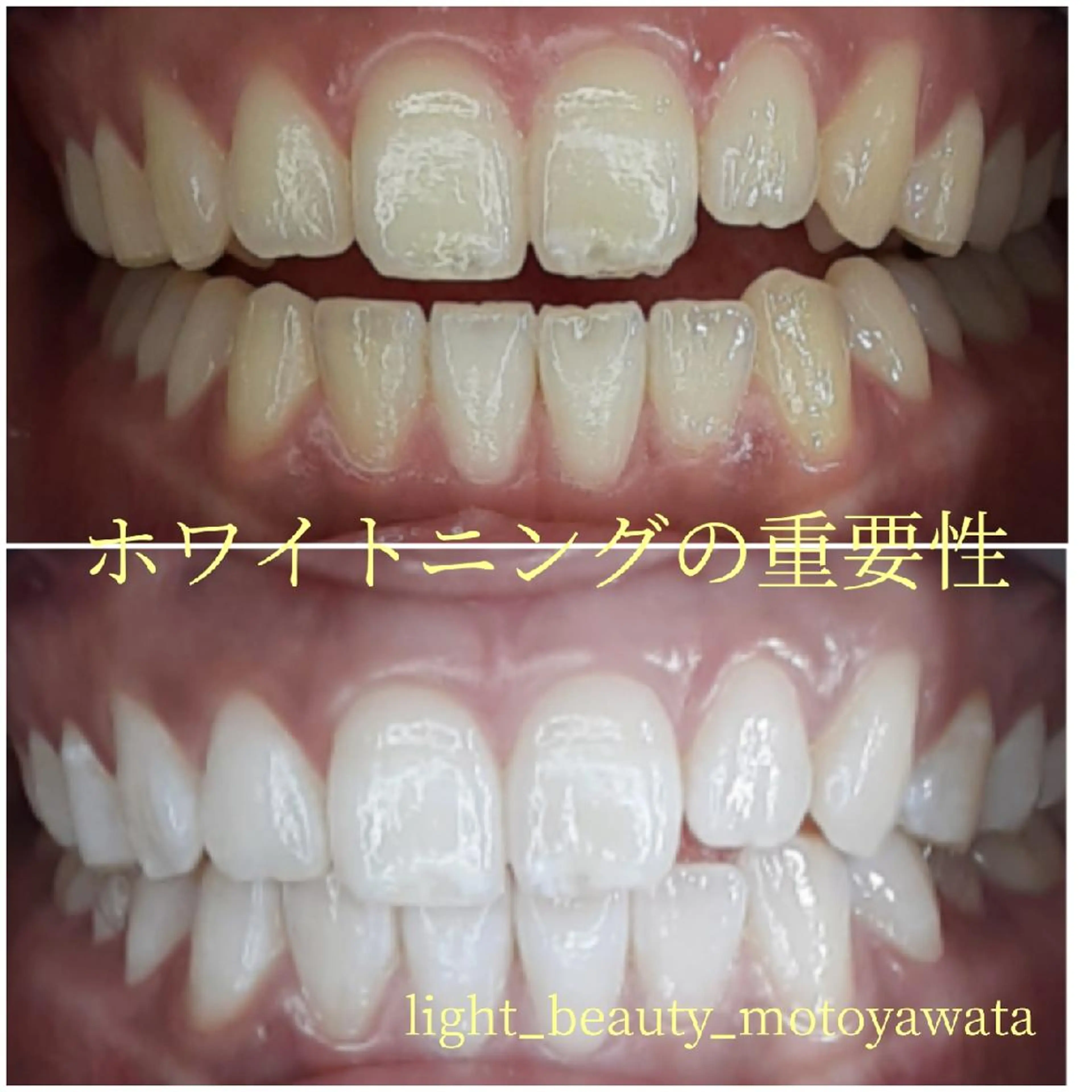 その他 五十嵐 蓮のその他イメージ