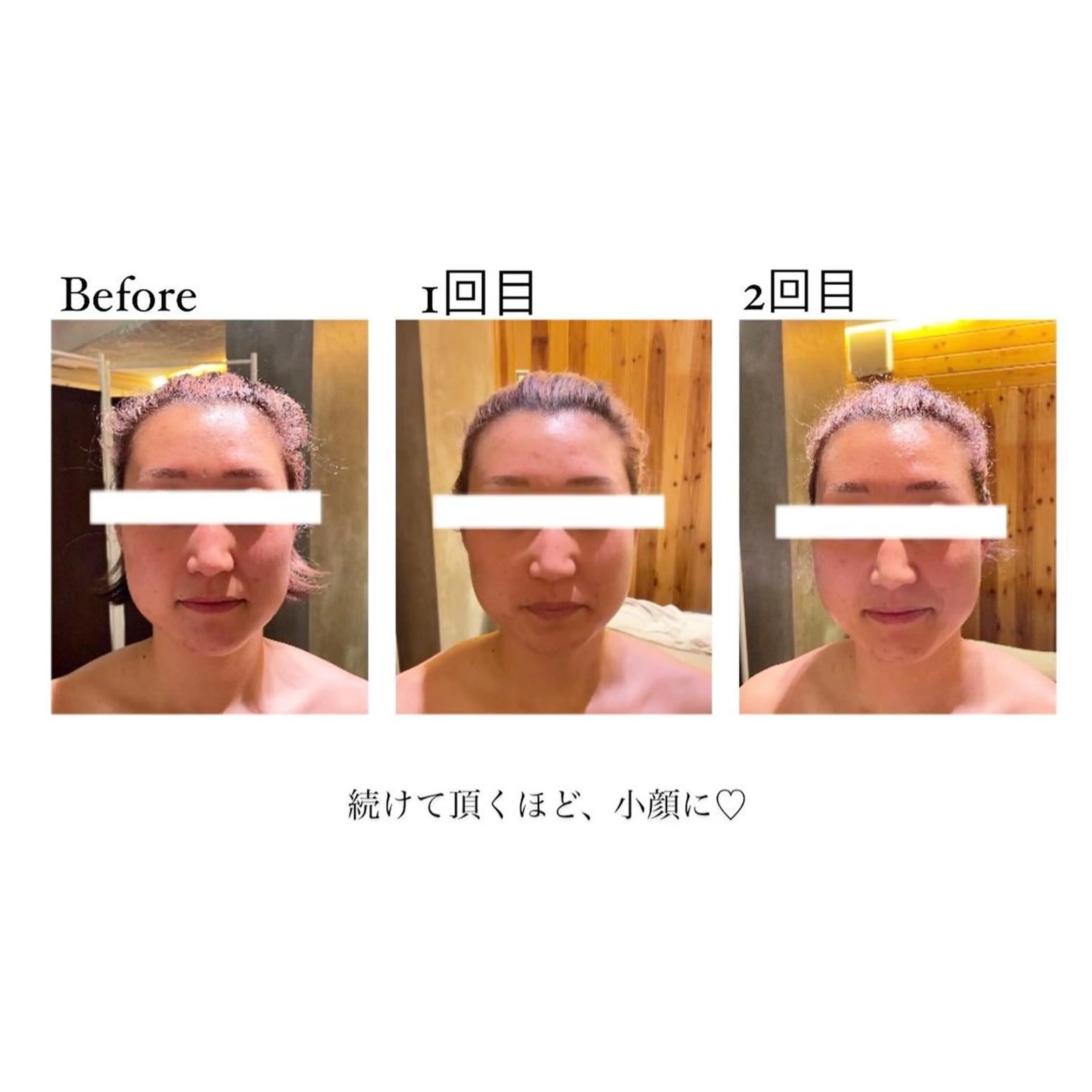 エステ リラク 寧♡ 美肌小顔・ボディケアのエステ・リラクイメージ