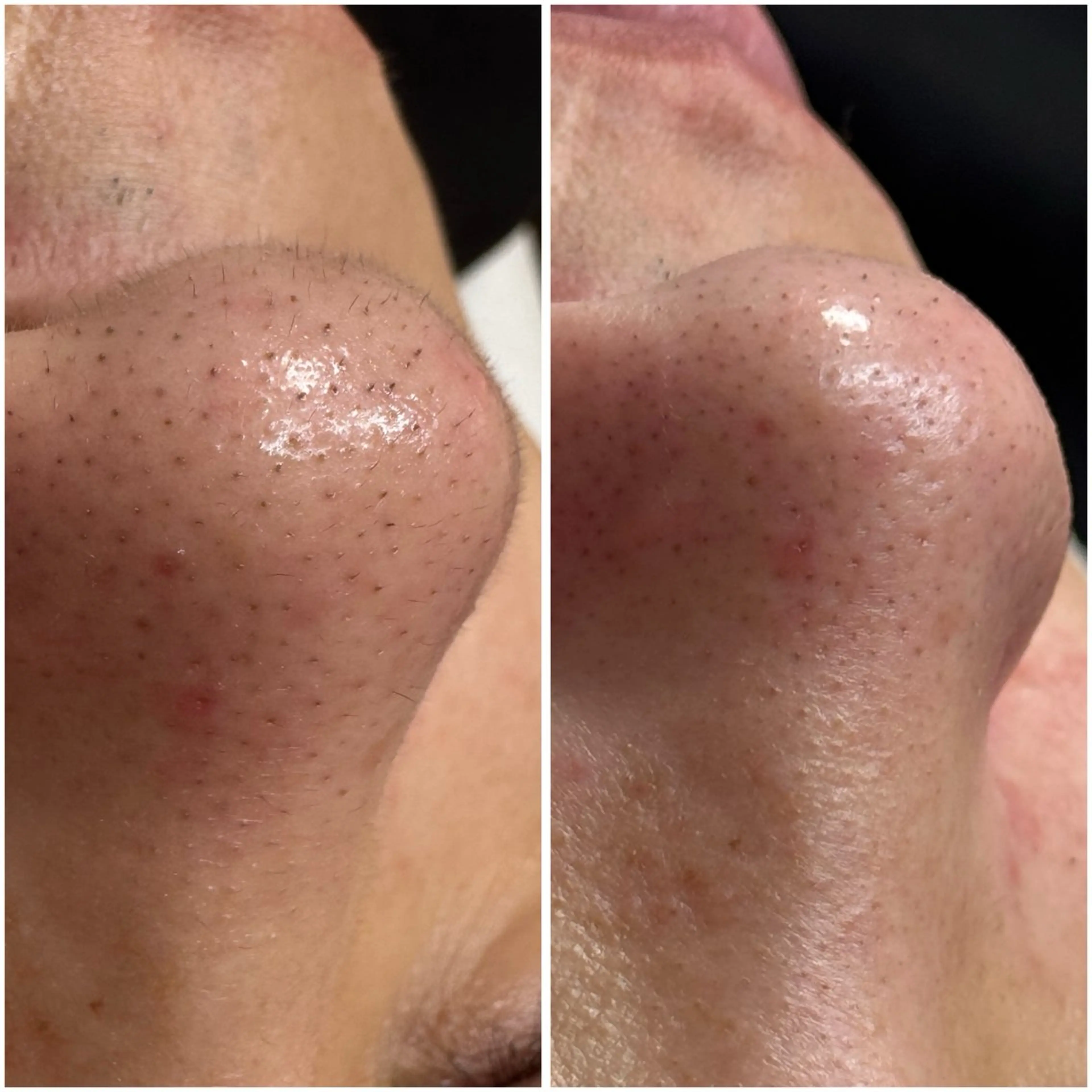 エステ yuuri. Sの眉毛・アイブロウイメージ