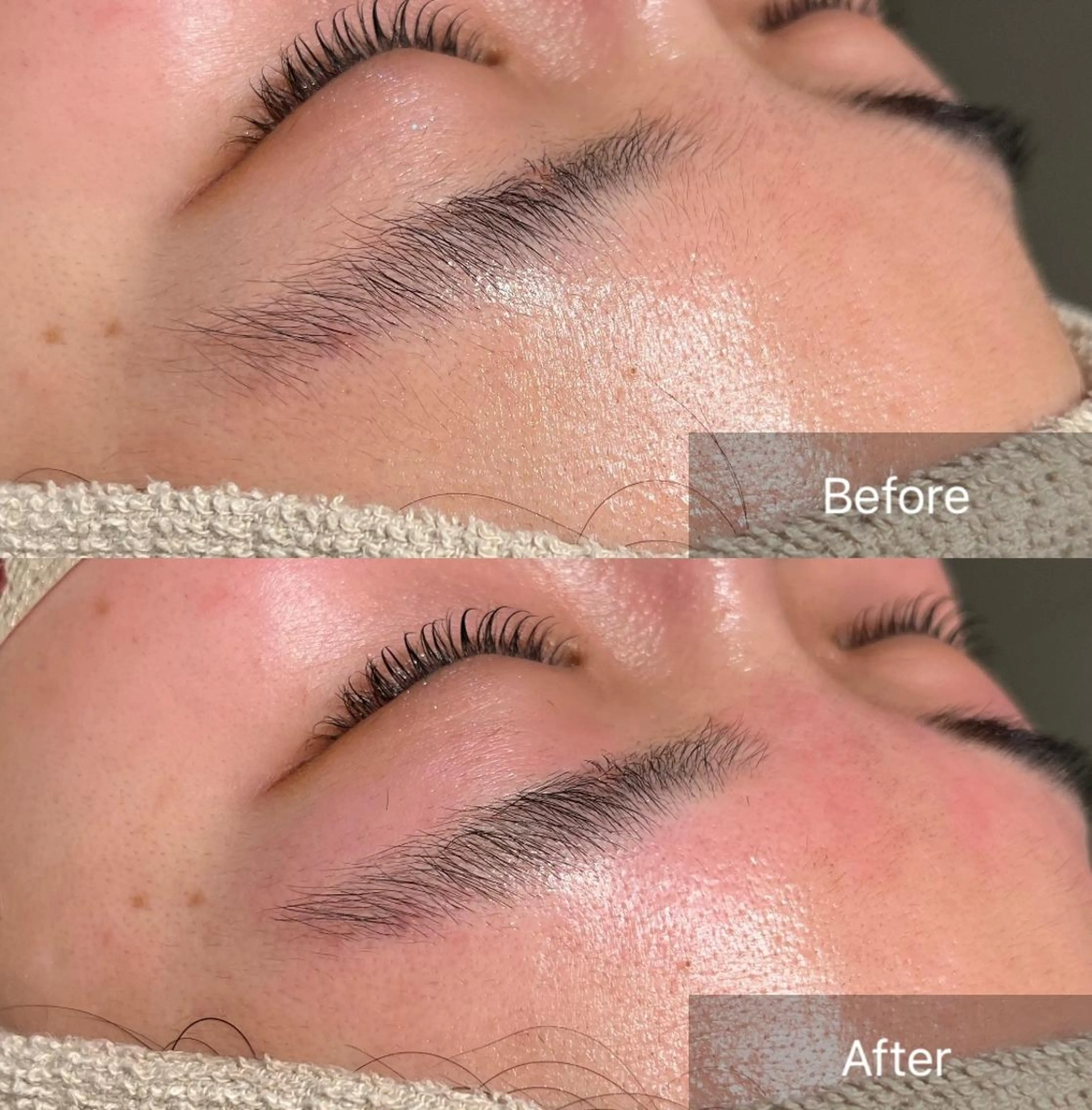 アイブロウ for woman所属・森 美優のエステ・リラクイメージ