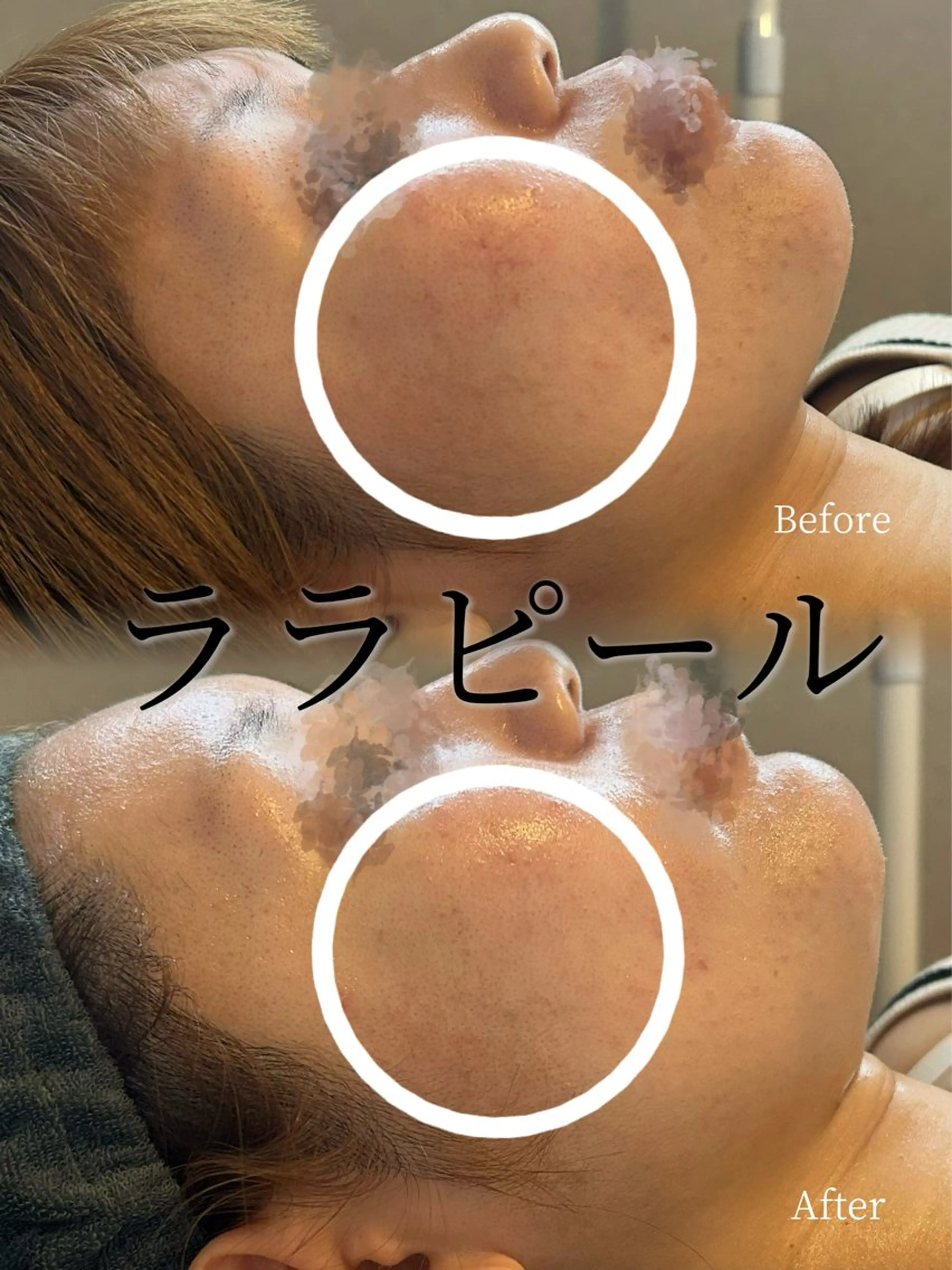 エステ Smoo アユミの眉毛・アイブロウイメージ