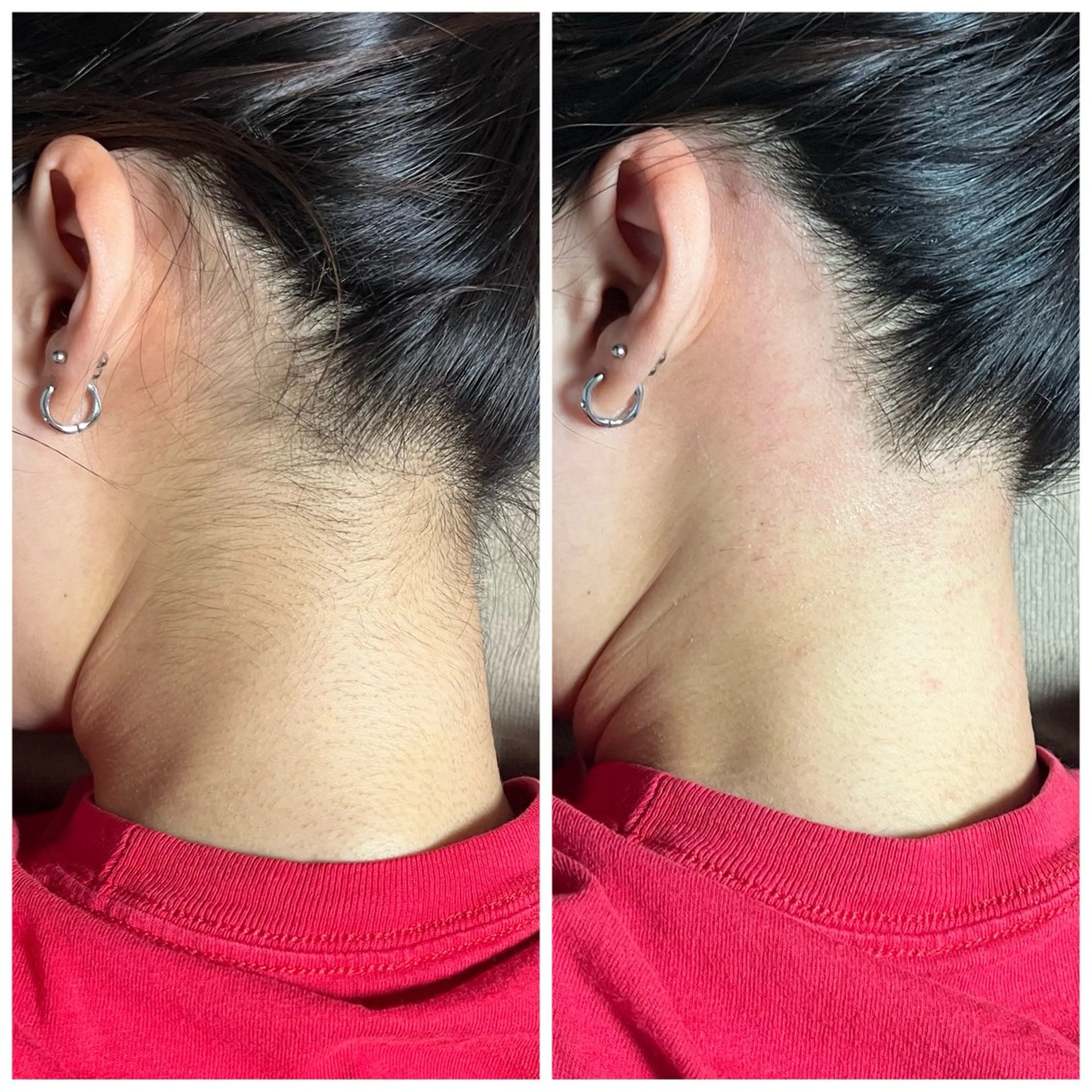 脱毛 頭痛肩こり改善/小顔 サロンB&H心斎橋の眉毛・アイブロウイメージ