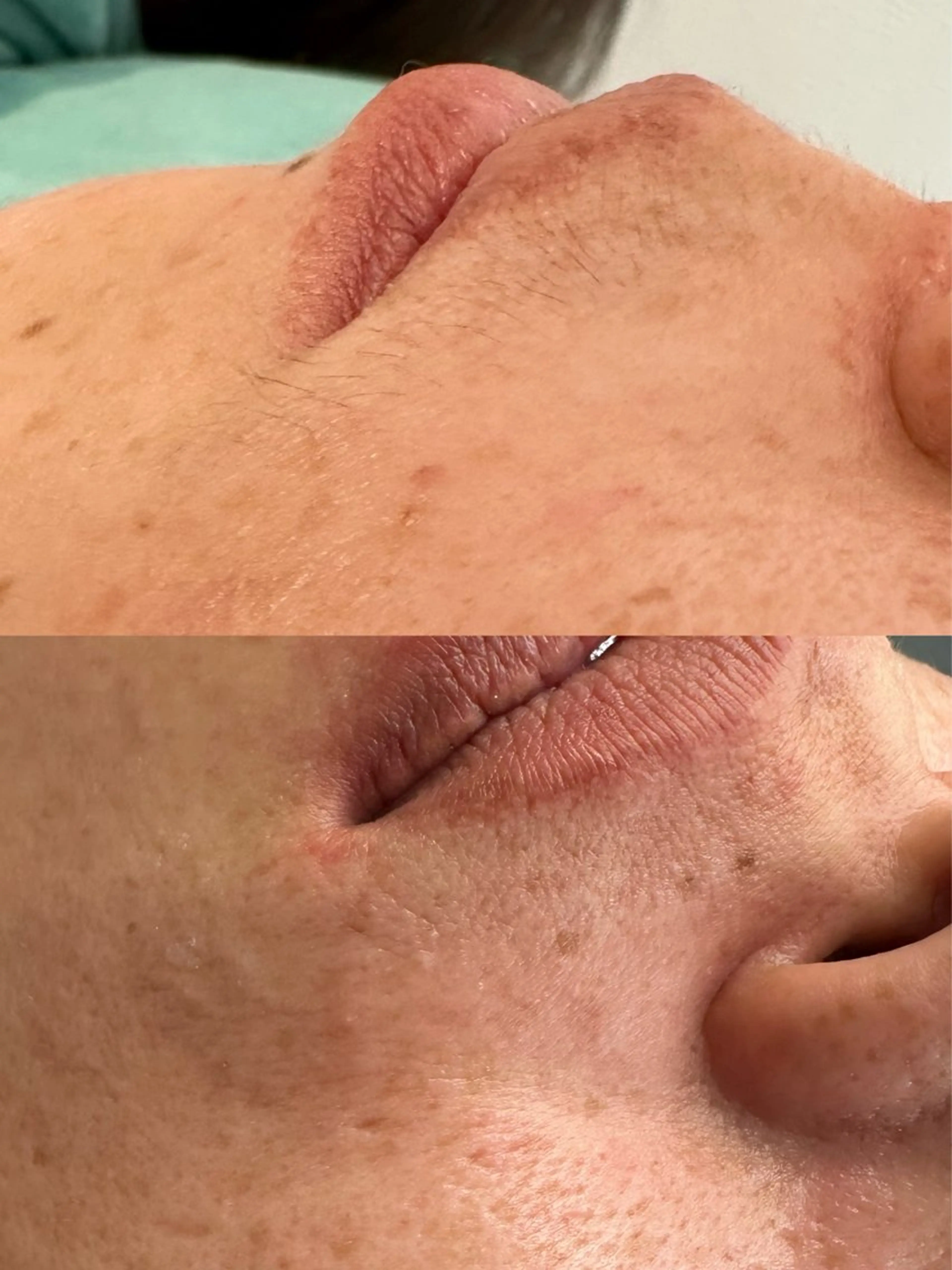 頭皮・薄毛改善サロン ｜眉毛｜痩身のエステ・リラクイメージ