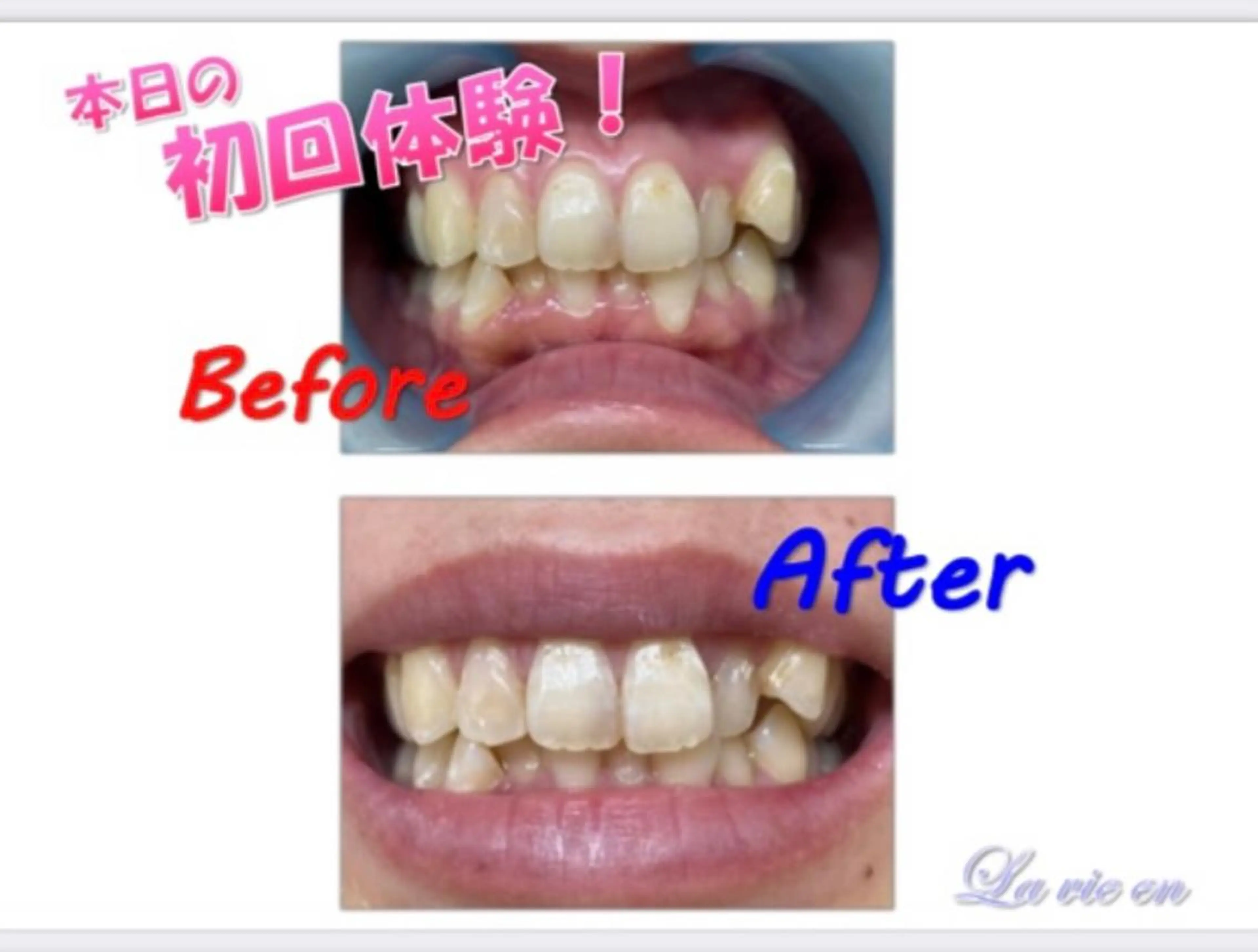 その他 ホワイトニングサロン La vie enのその他イメージ