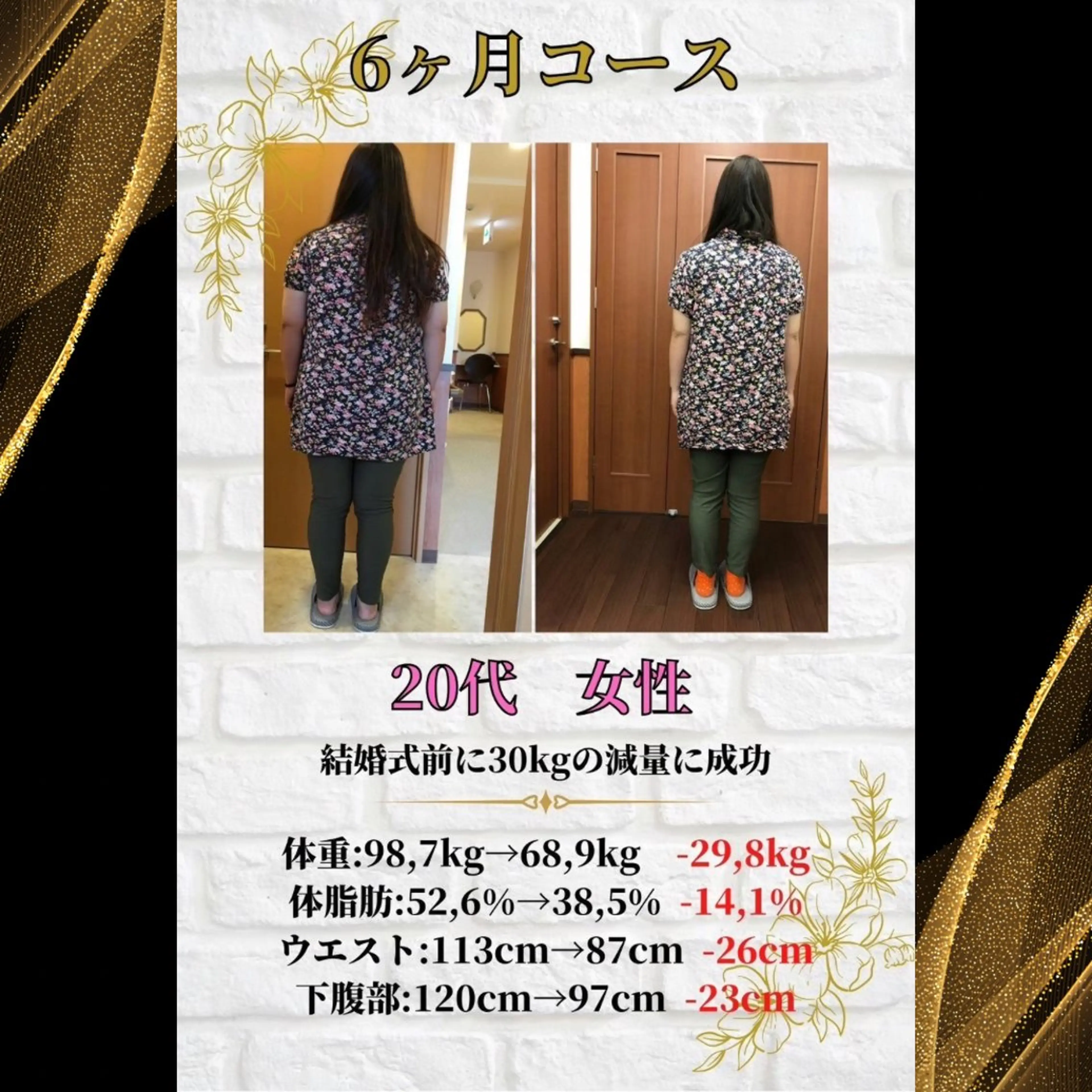 エステ ピラティス/姿勢改善 /美容整体師　宮﨑のエステ・リラクイメージ