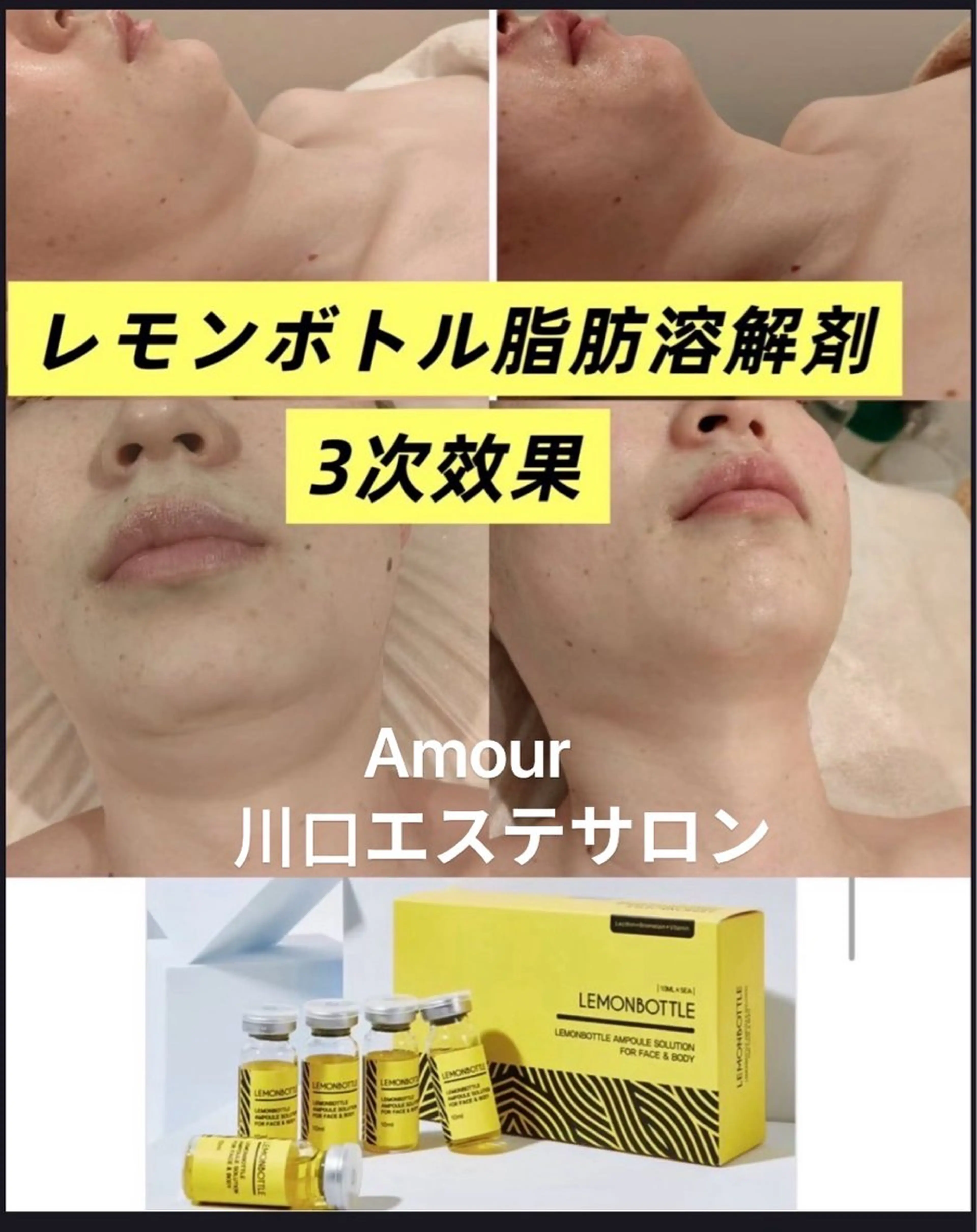 痩身・小顔・脱毛・ オイル&Amourのその他イメージ