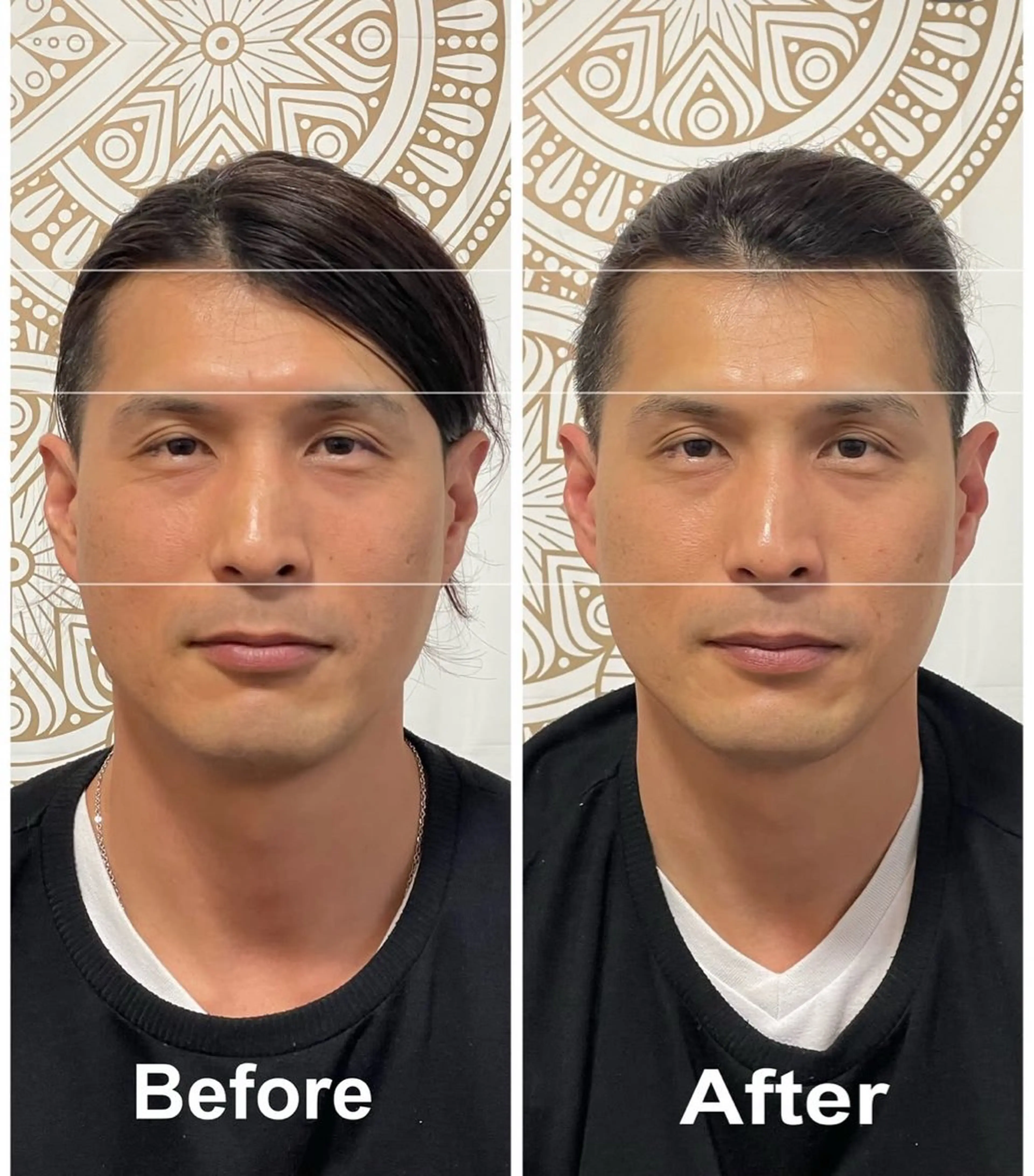 あだち整体エステ 首肩背中のゆるめぐのエステ・リラクイメージ