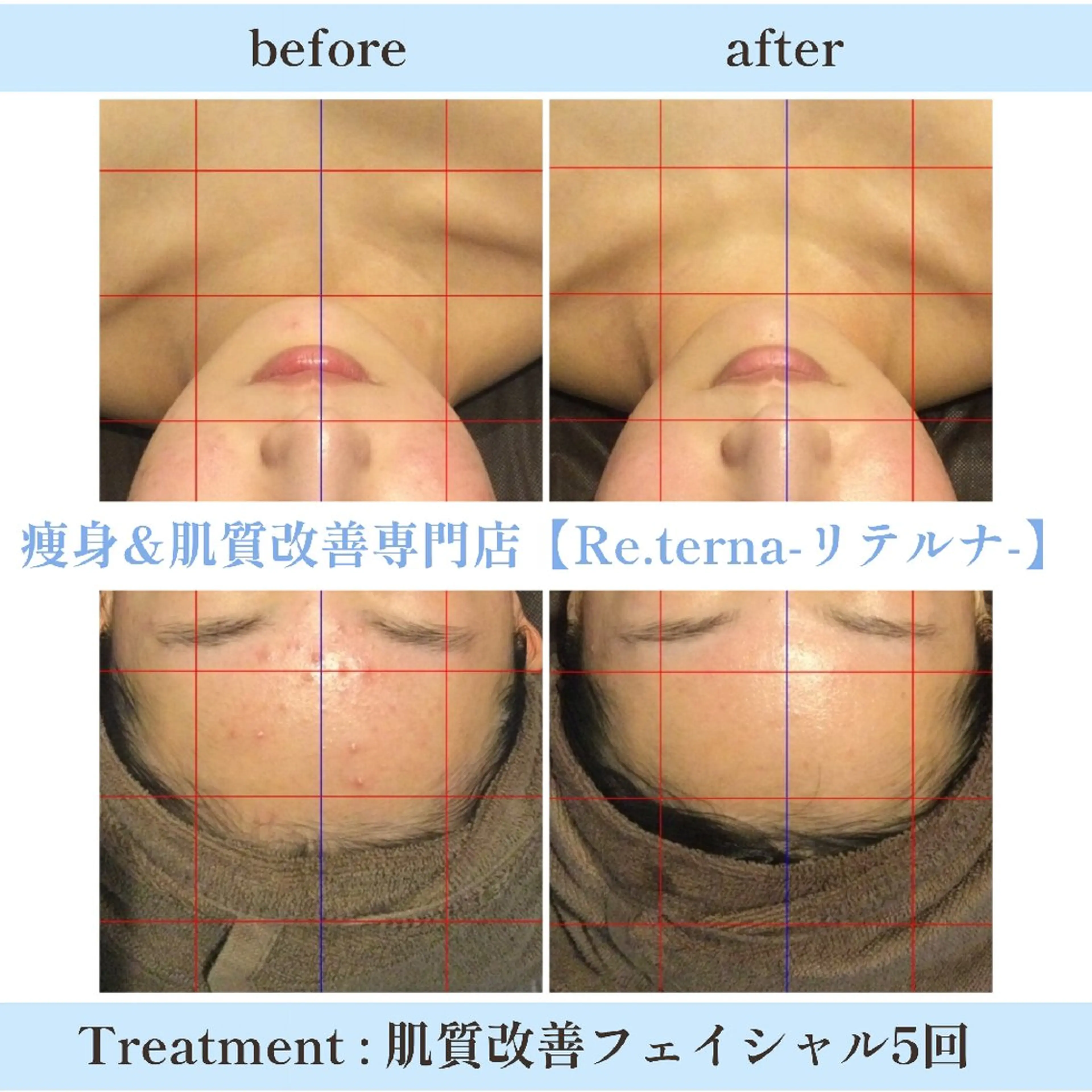 肌質改善専門店 Re.terna田辺のエステ・リラクイメージ