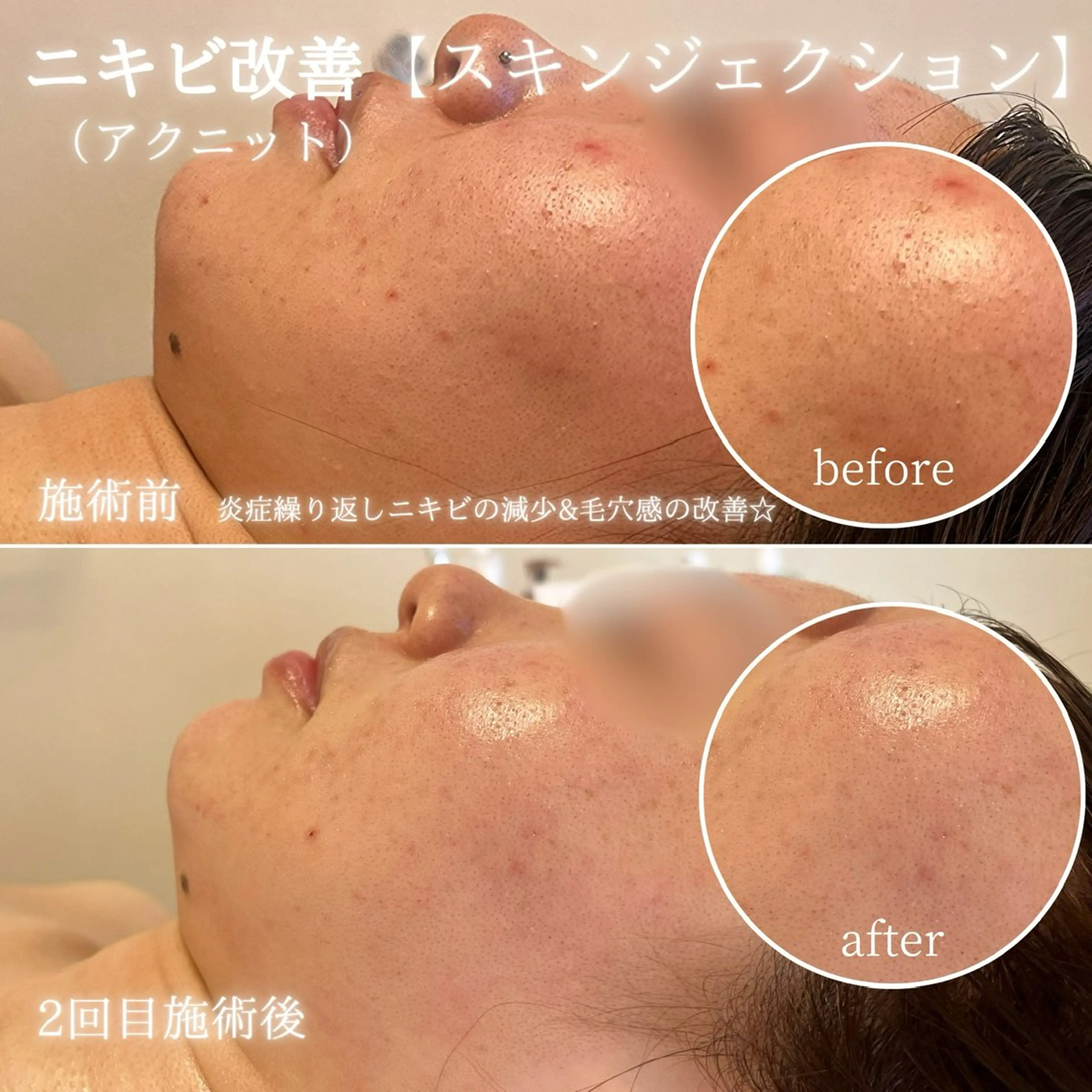 エステ リラク La Dusa 韓国肌管理/小波のエステ・リラクイメージ