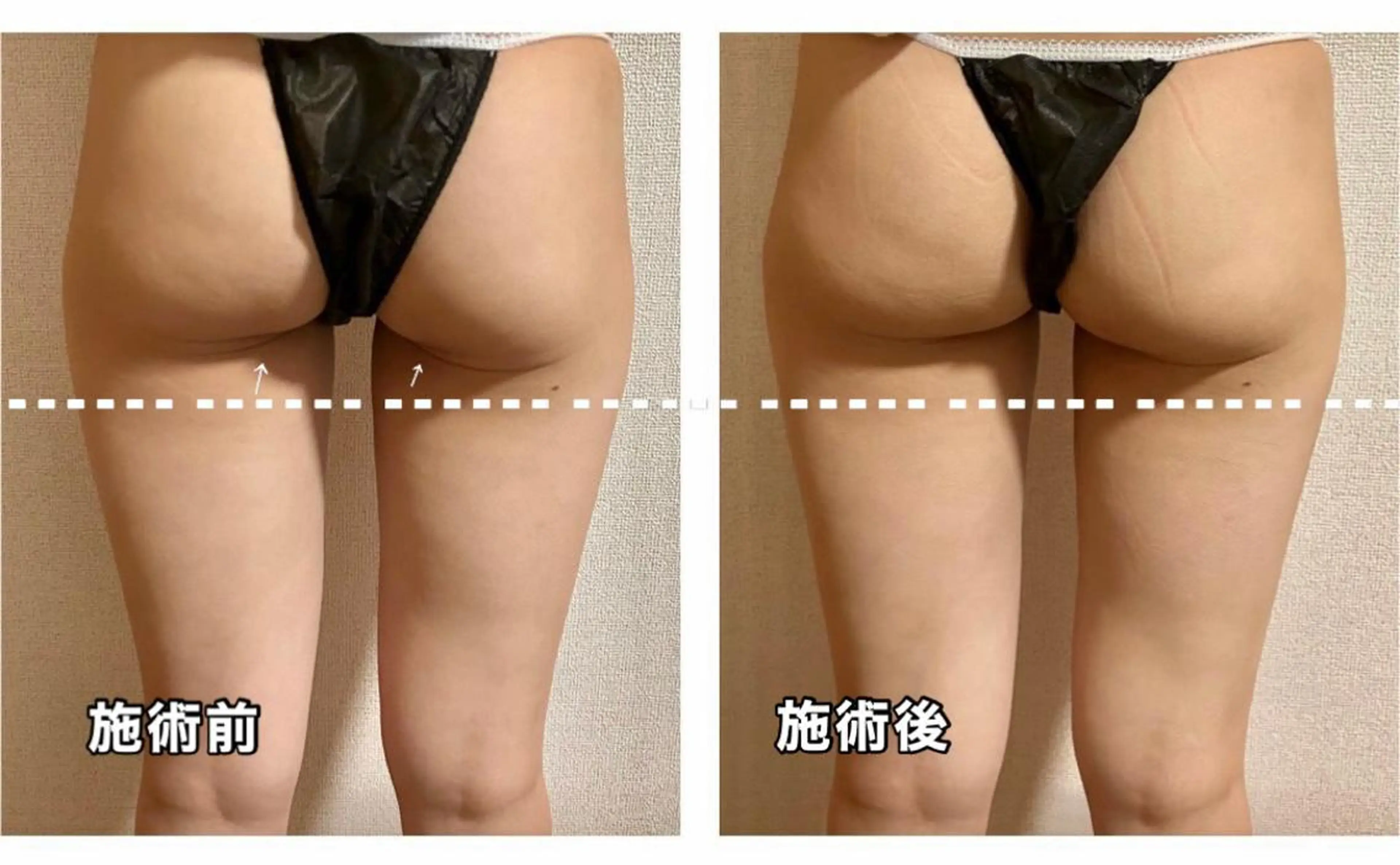 🌴Beauty Salon LANAのエステ・リラクイメージ