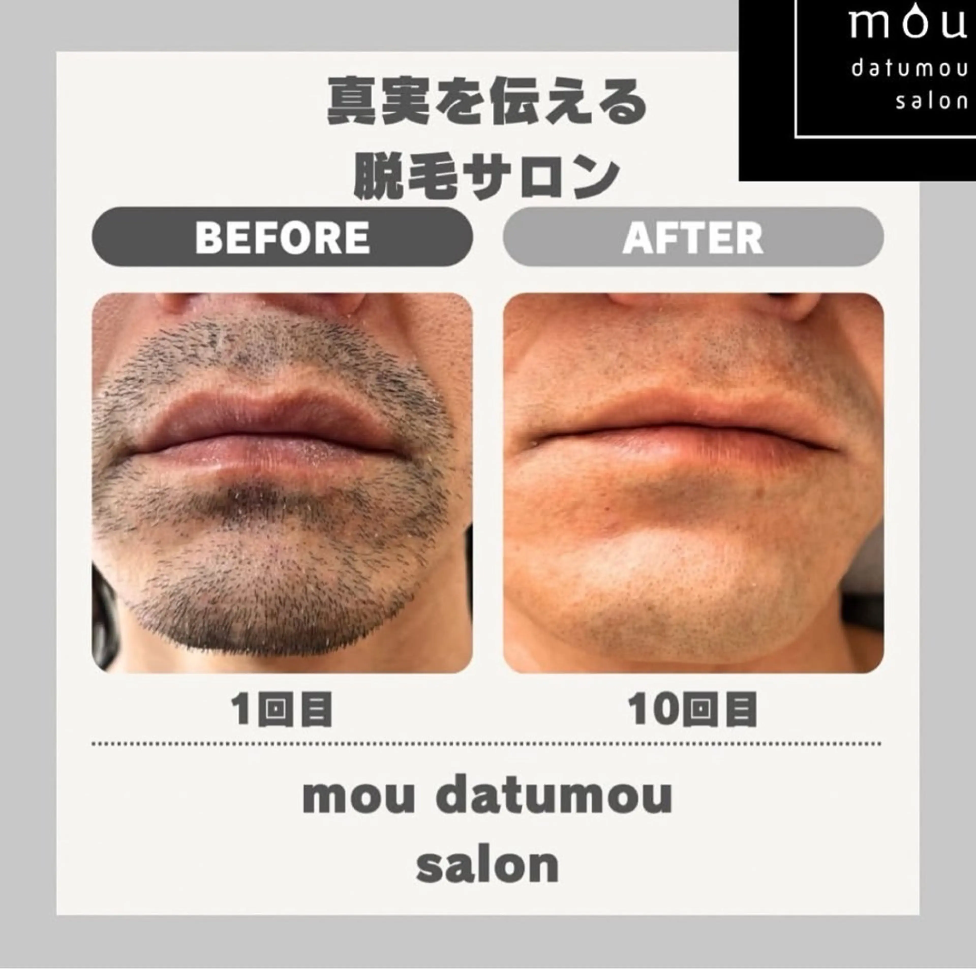 脱毛 moudatumou salonのエステ・リラクイメージ