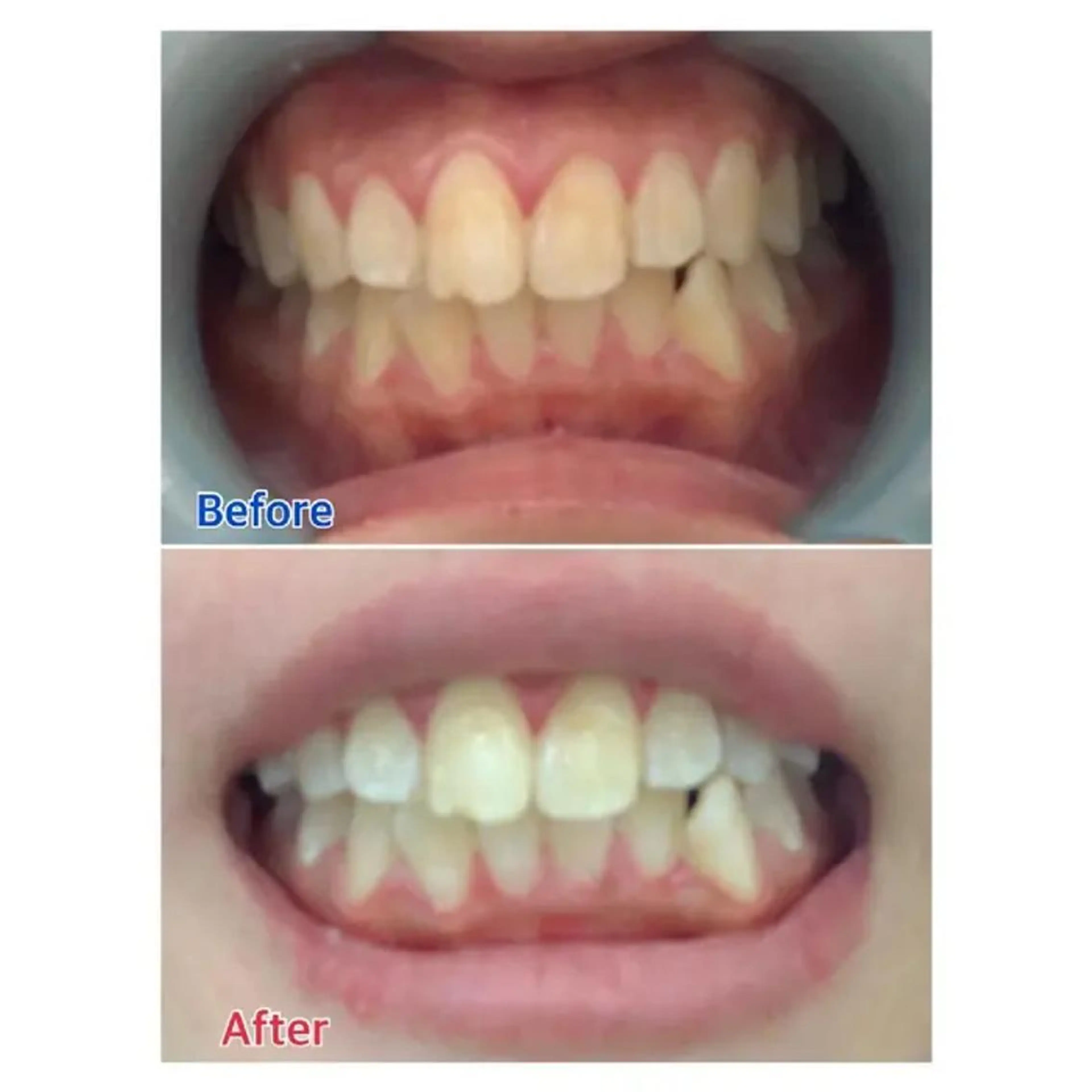 M渋谷 ホワイトニングのエステ・リラクイメージ