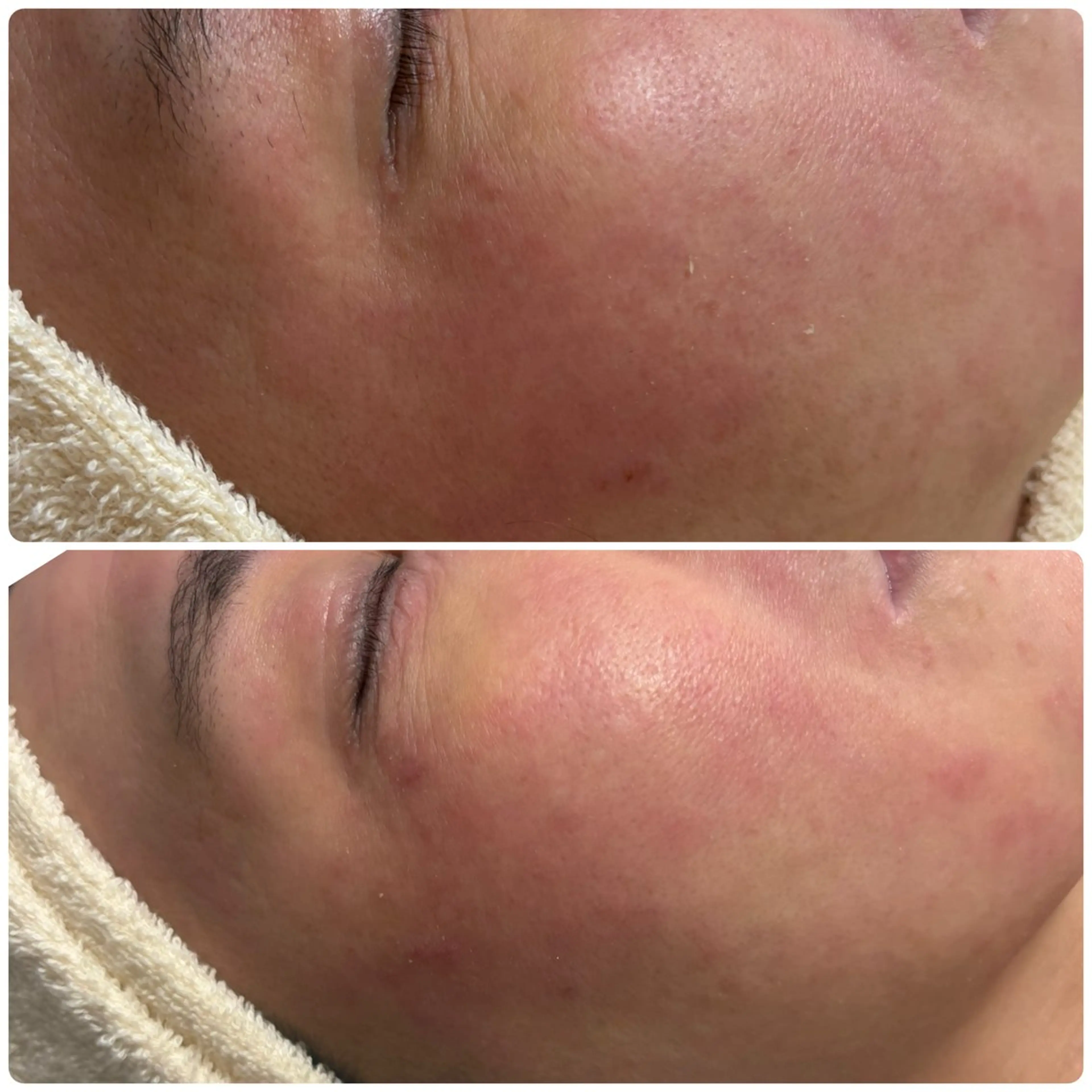 エステ 美と健康サロン Lino leaのエステ・リラクイメージ