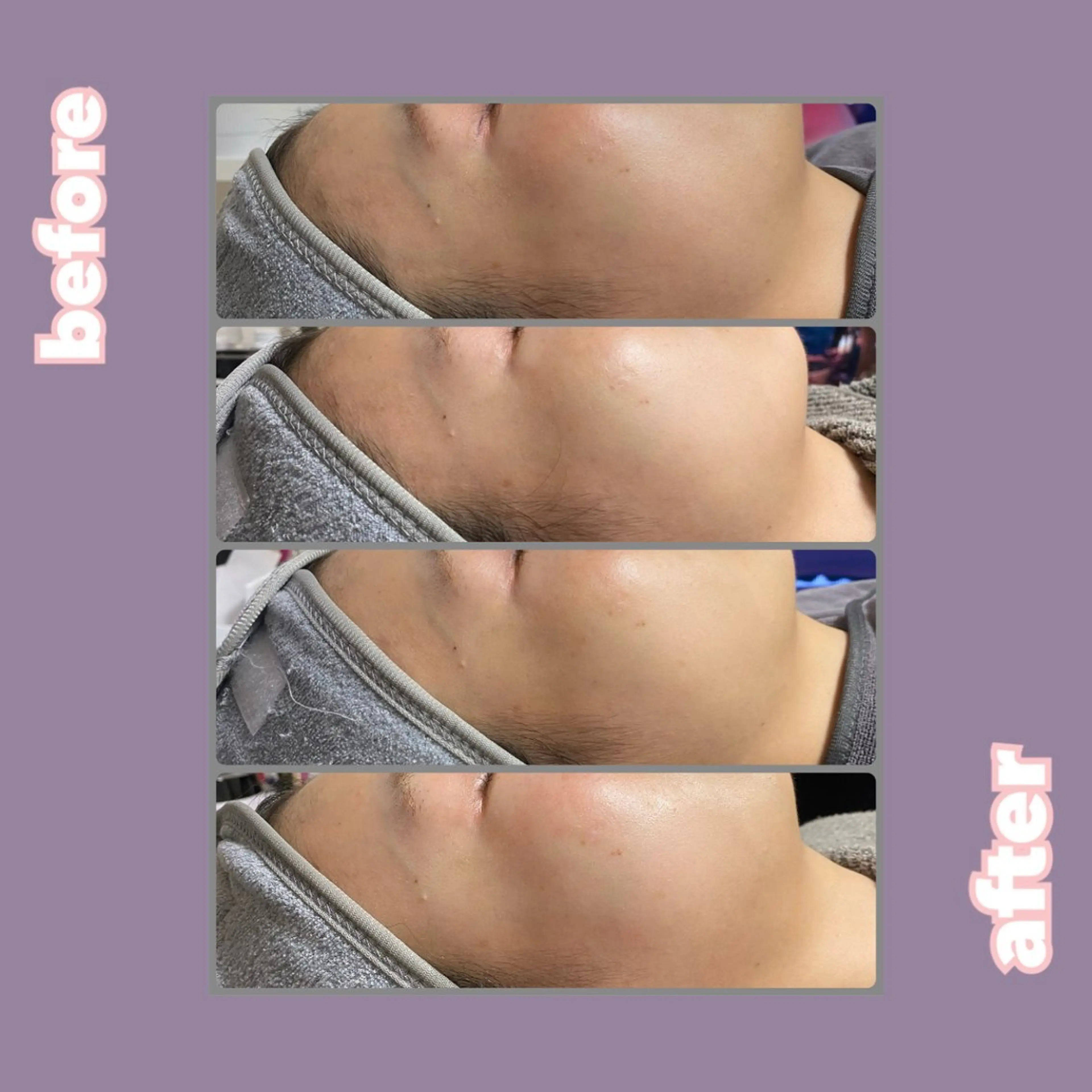 冷えむくみ改善専門 REBISKIN🌿のエステ・リラクイメージ