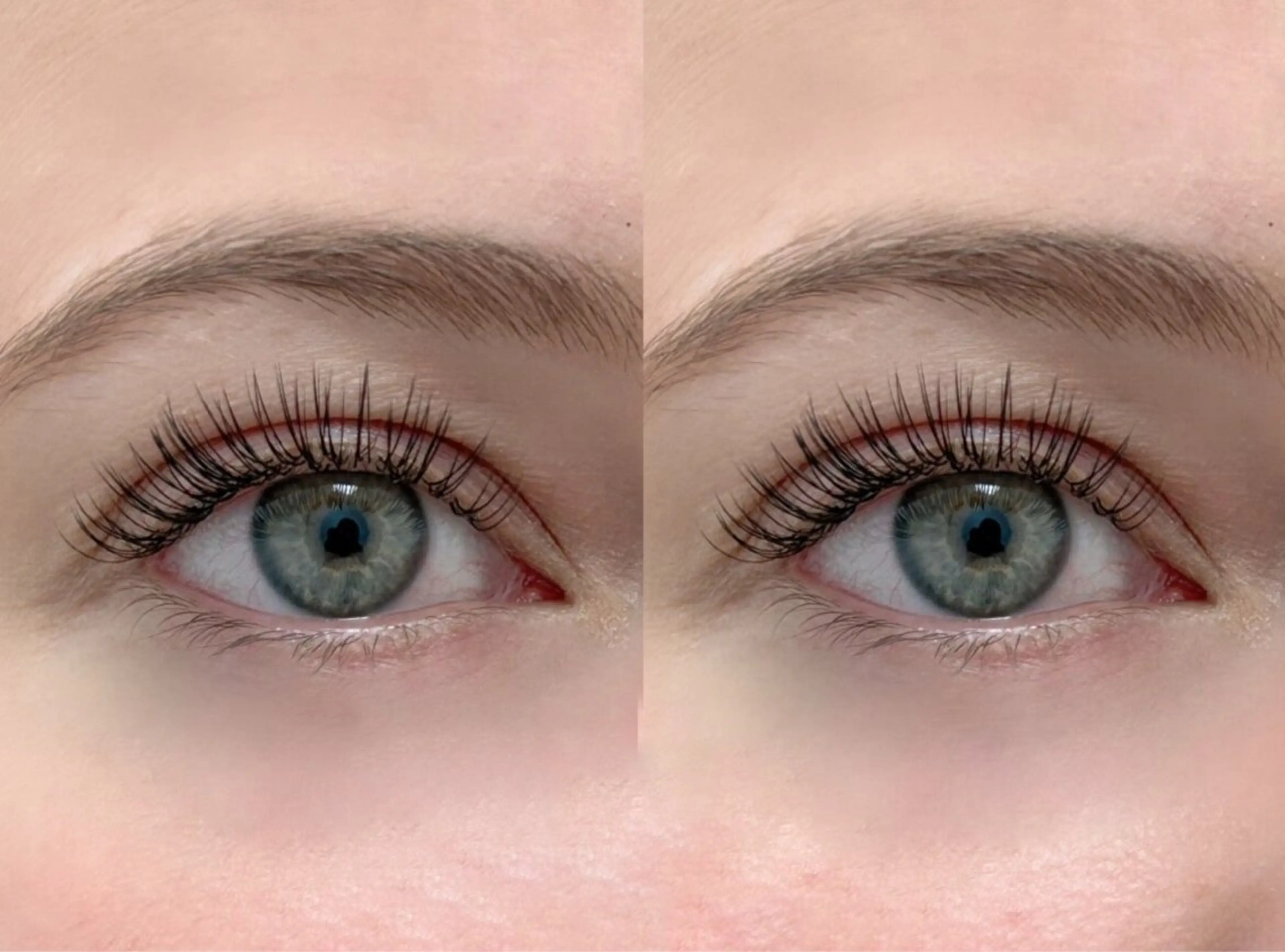 フラットラッシュ120本の写真