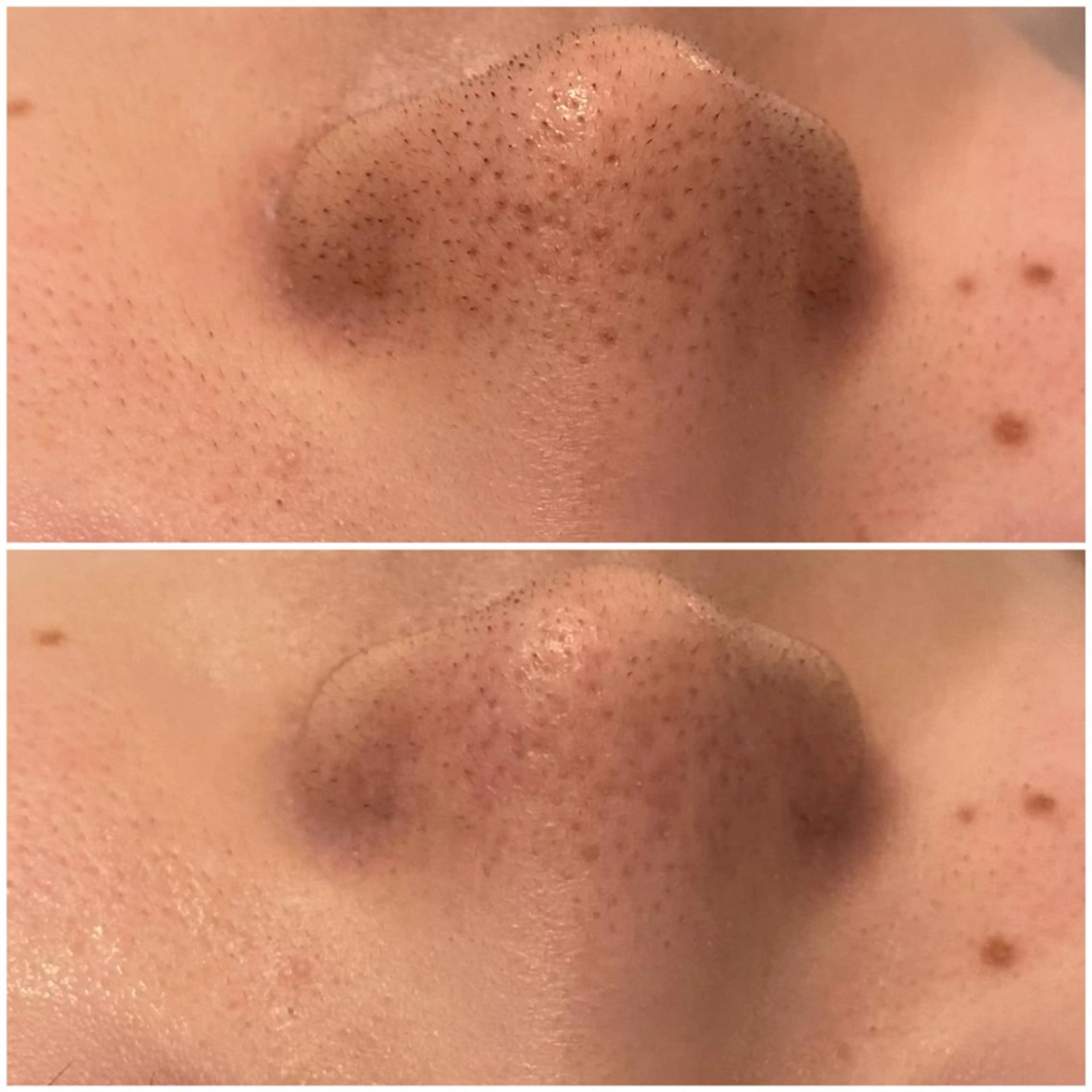 ララ/ハーブ メゾンリュバンのエステ・リラクイメージ