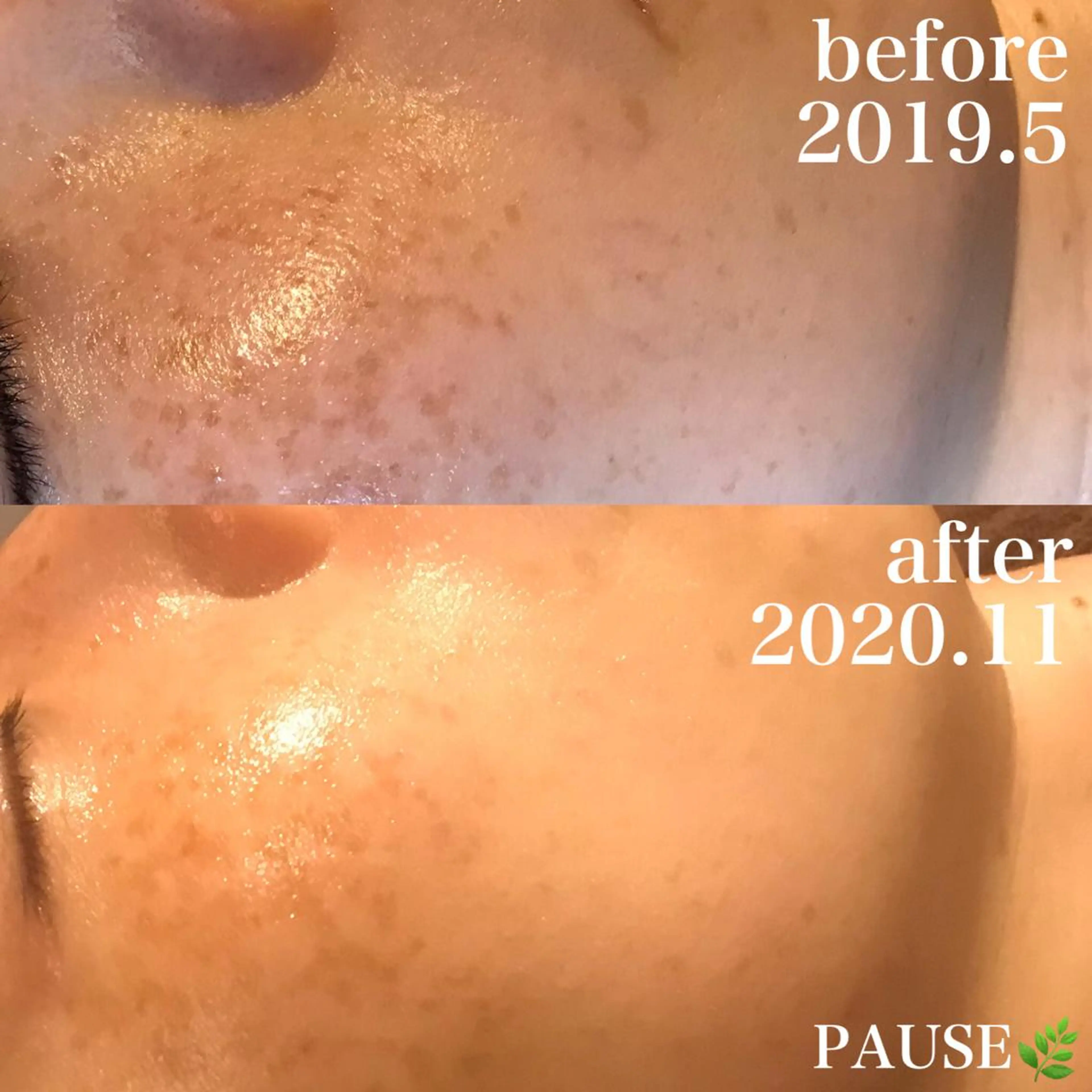 エステ 浜野 恵美のエステ・リラクイメージ