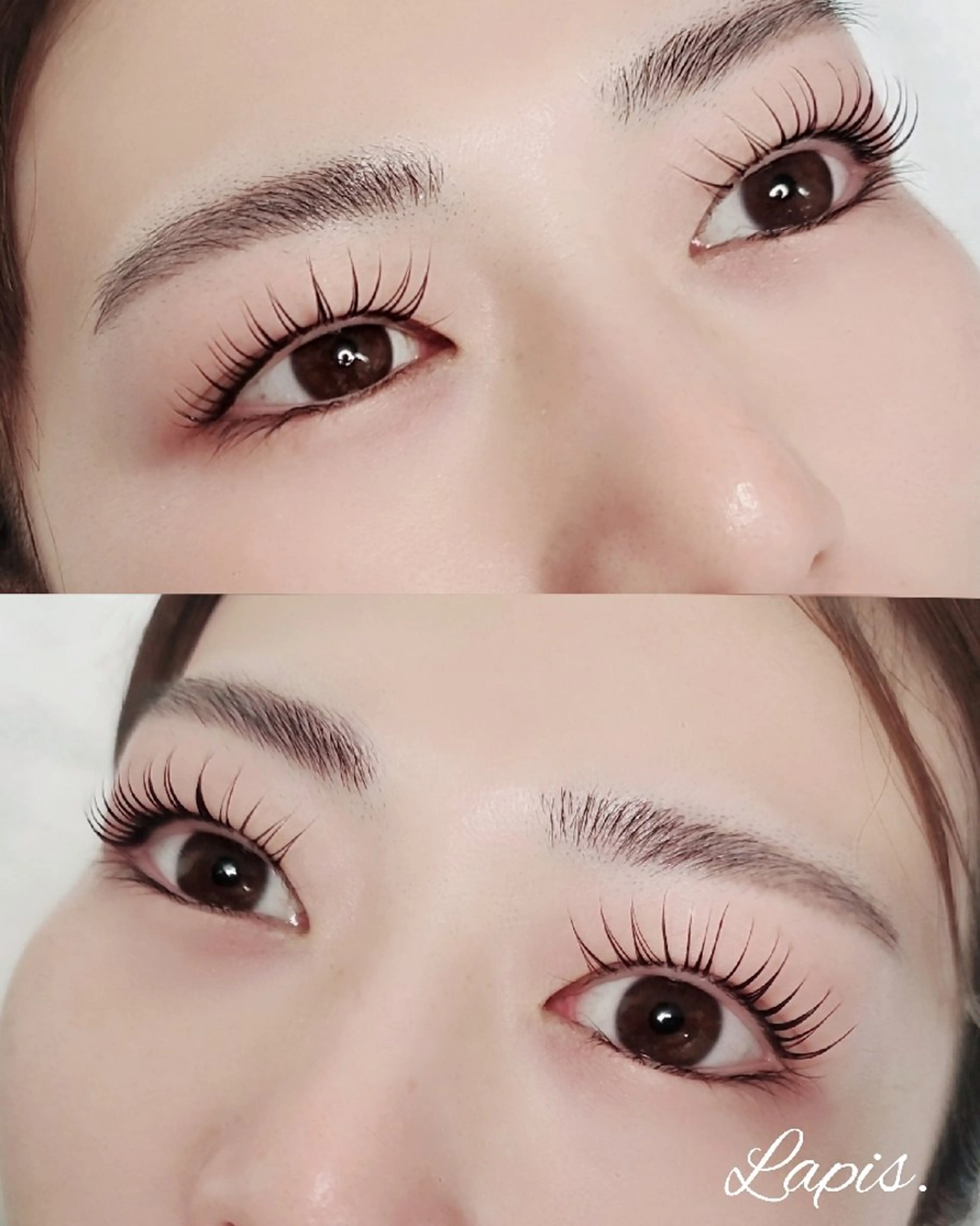 パリジェンヌリフトの写真