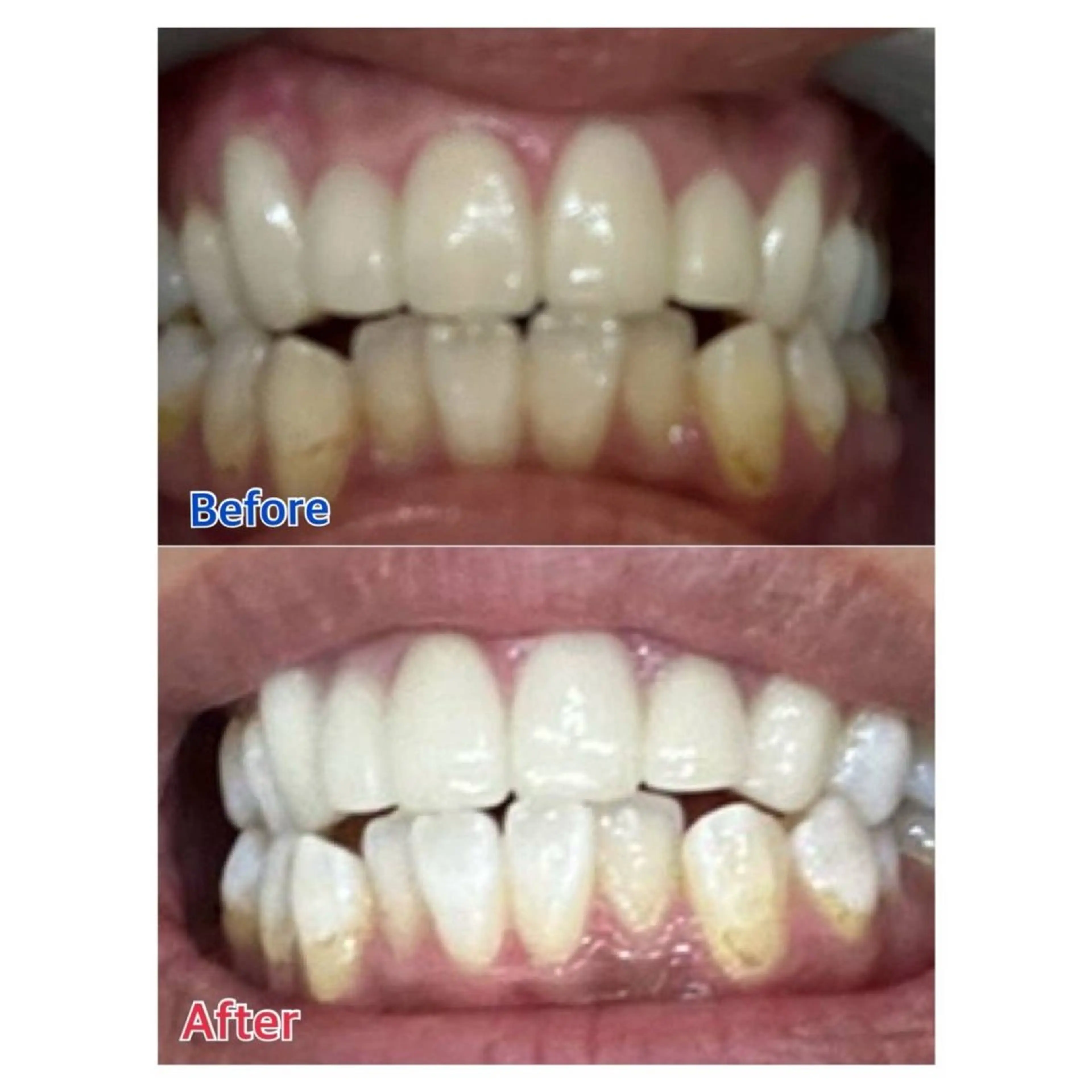 MBEAUTYSALON 千葉店・京成大久保所属・Melty 輝のその他イメージ