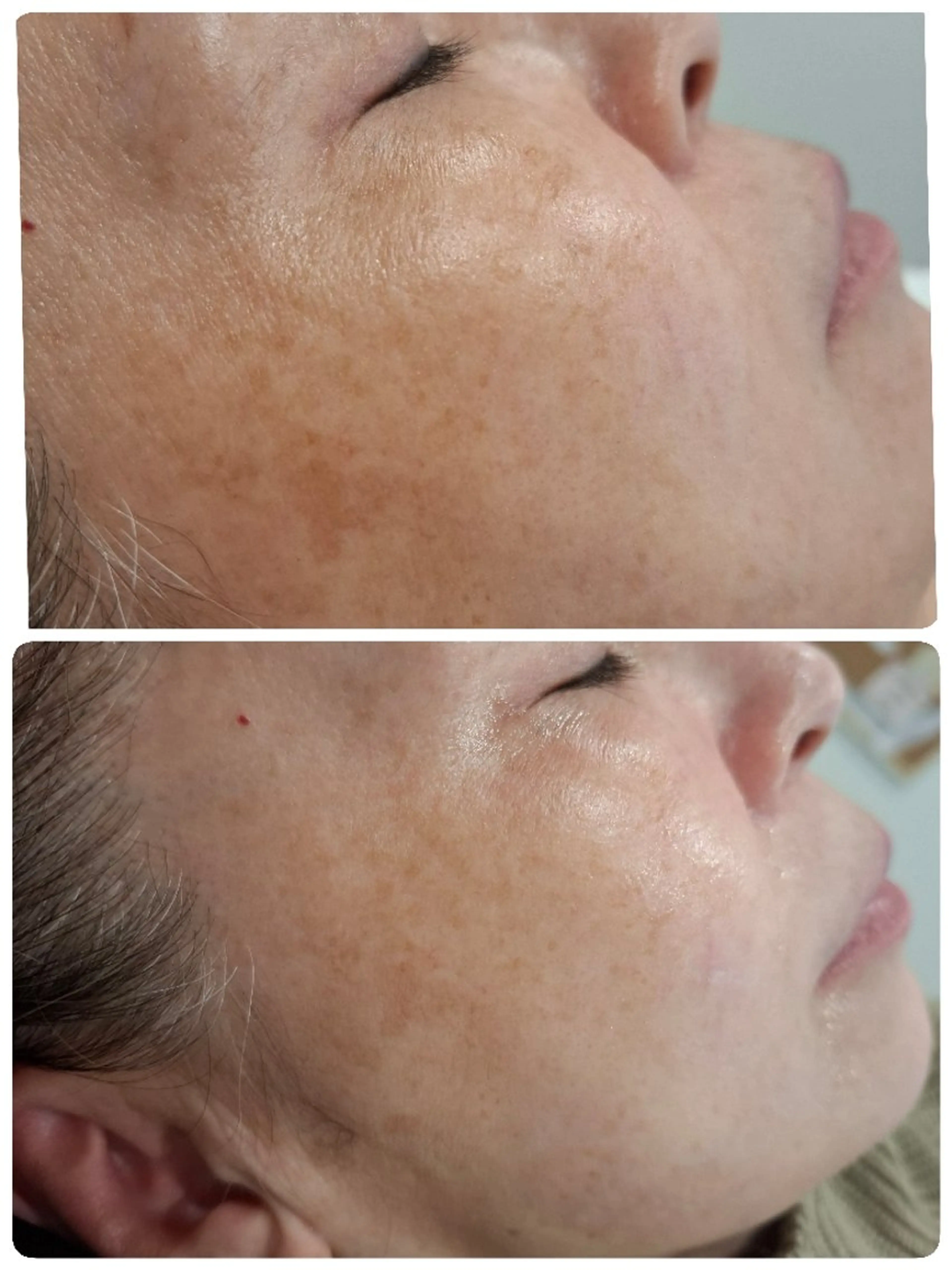 CSP クリアスキンプログラム フェイシャルワックスフラッシュマジックの写真