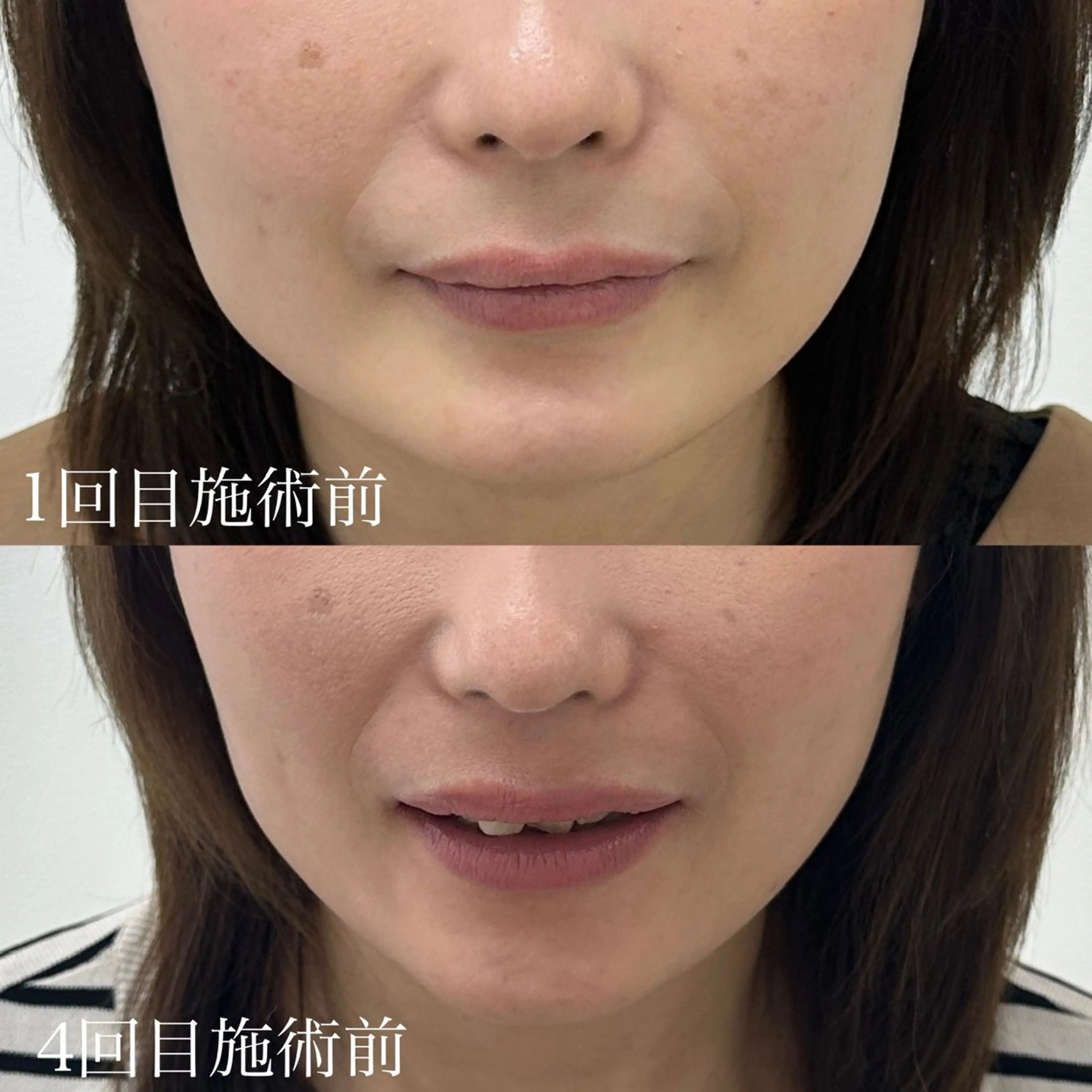 relle (リル)のネイルデザイン