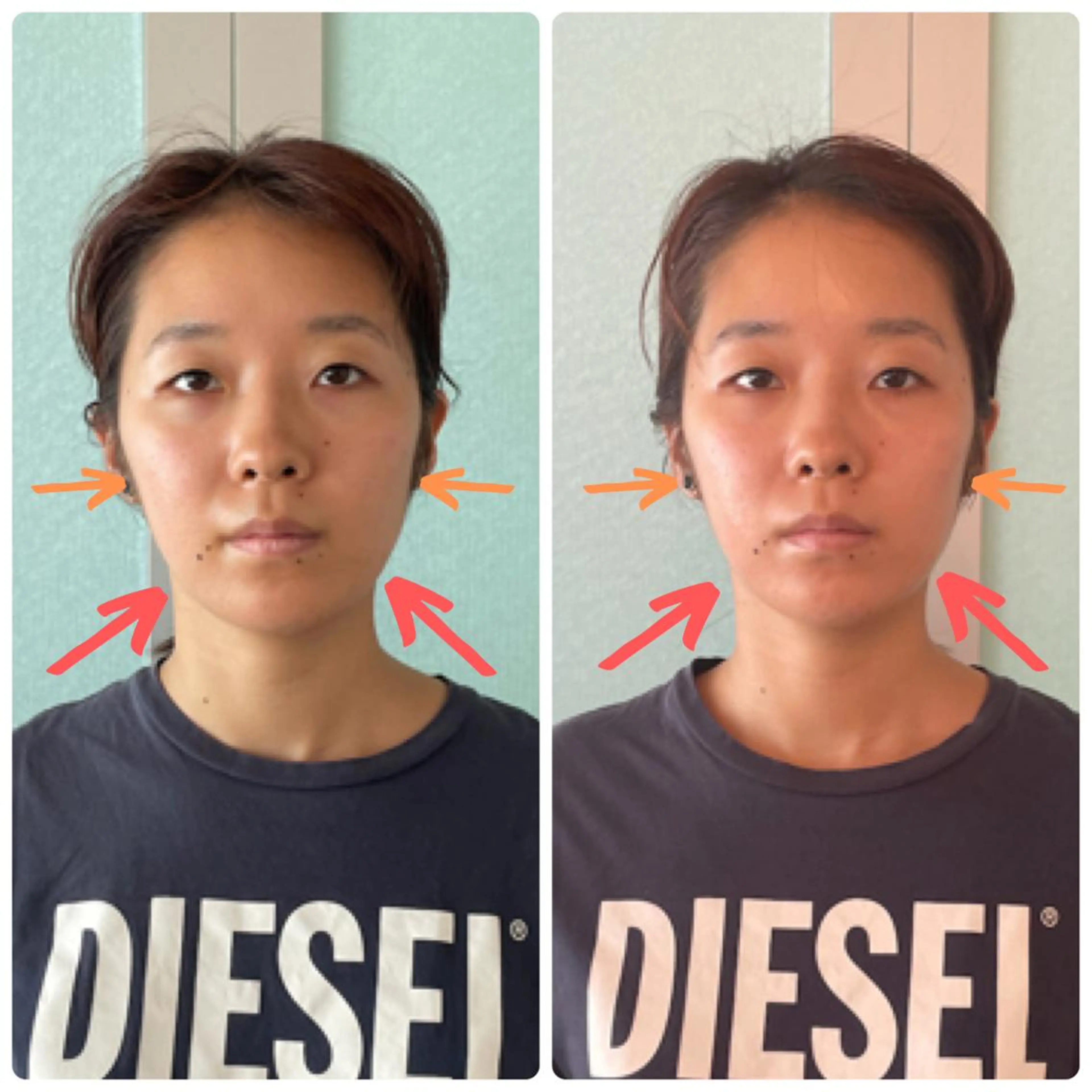 hapi_chura 《ハピちゅら》のエステ・リラクイメージ