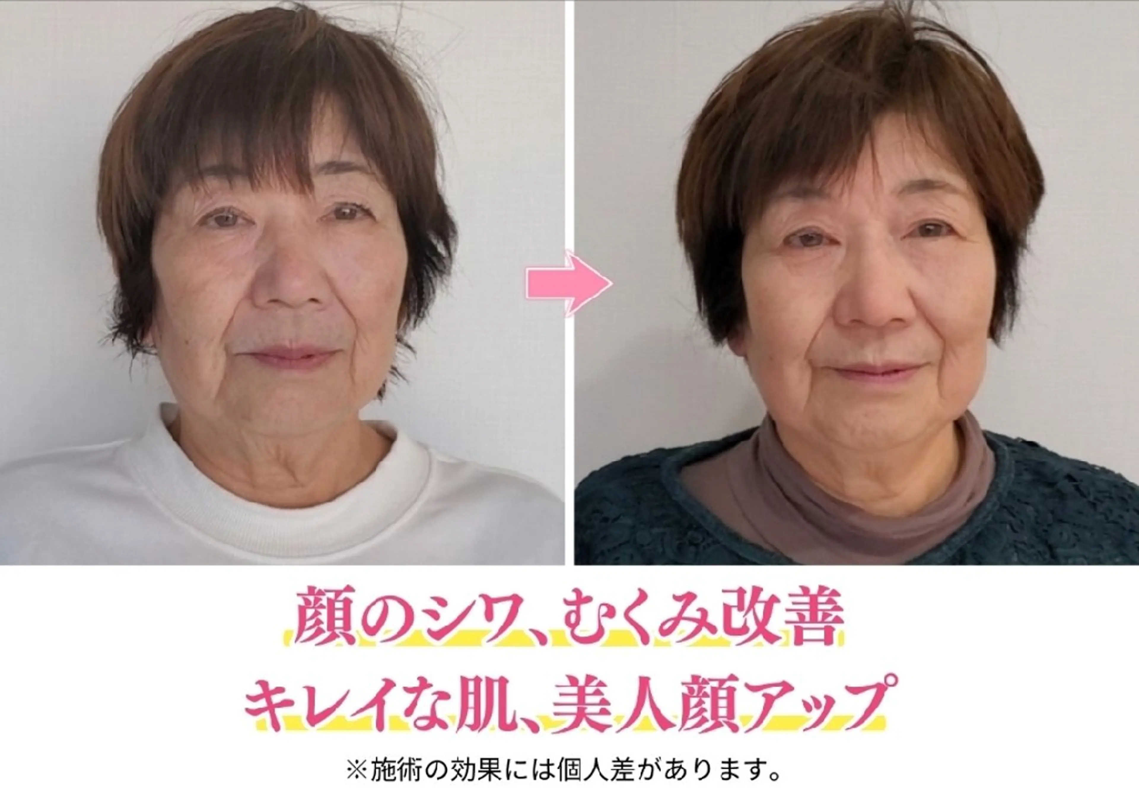 美容整体サロン DOLCE のエステ・リラクイメージ