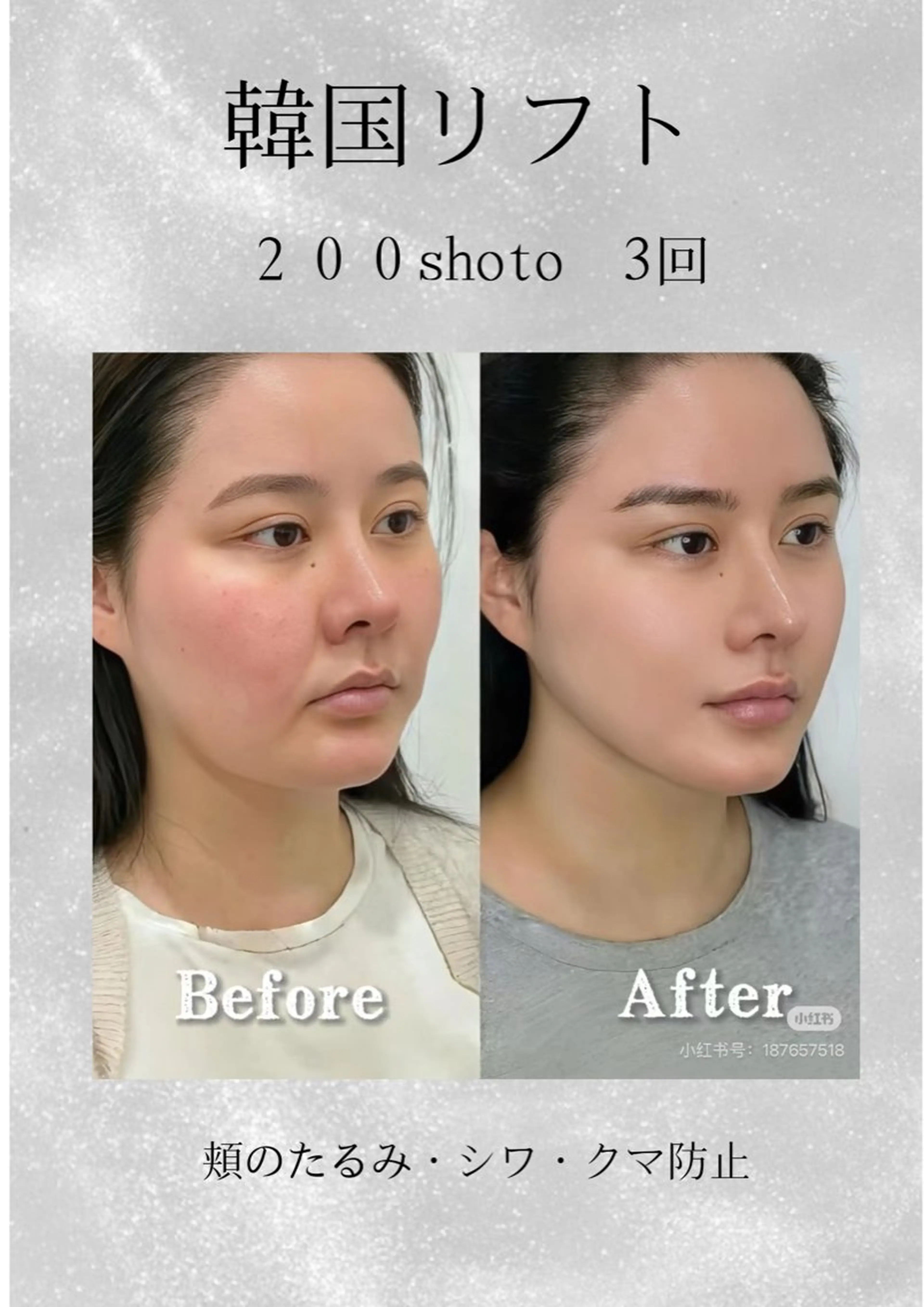 マツエク・マツパ エステ aliaハイフ&水光ジェットサロン所属・aliaハーブ水光店 エステティシャン募集のエステ・リラクイメージ