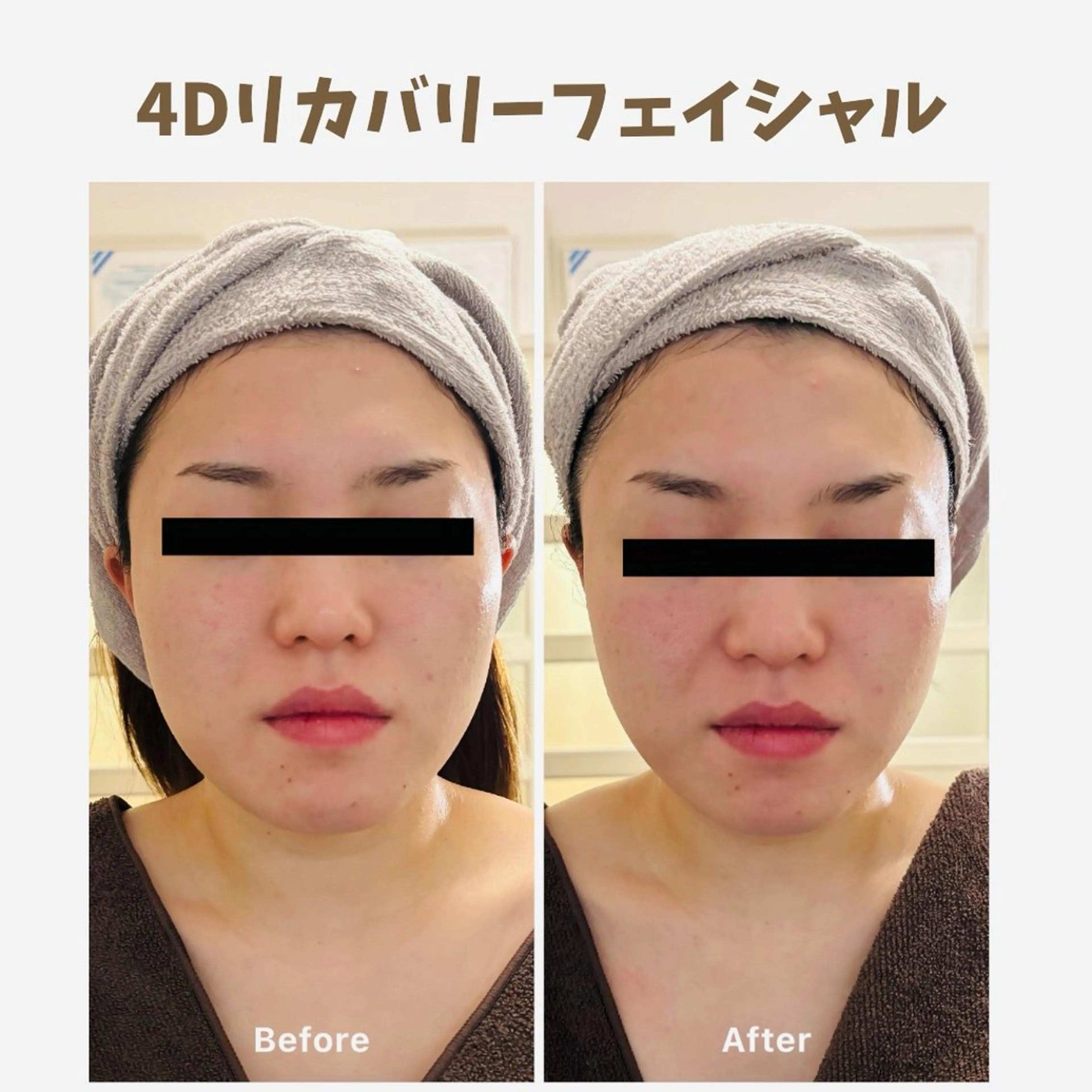 💖小顔ケア・肌再生・リラックスを同時に叶える💖4Dリカバリーフェイシャル (施術時間約60分)の写真