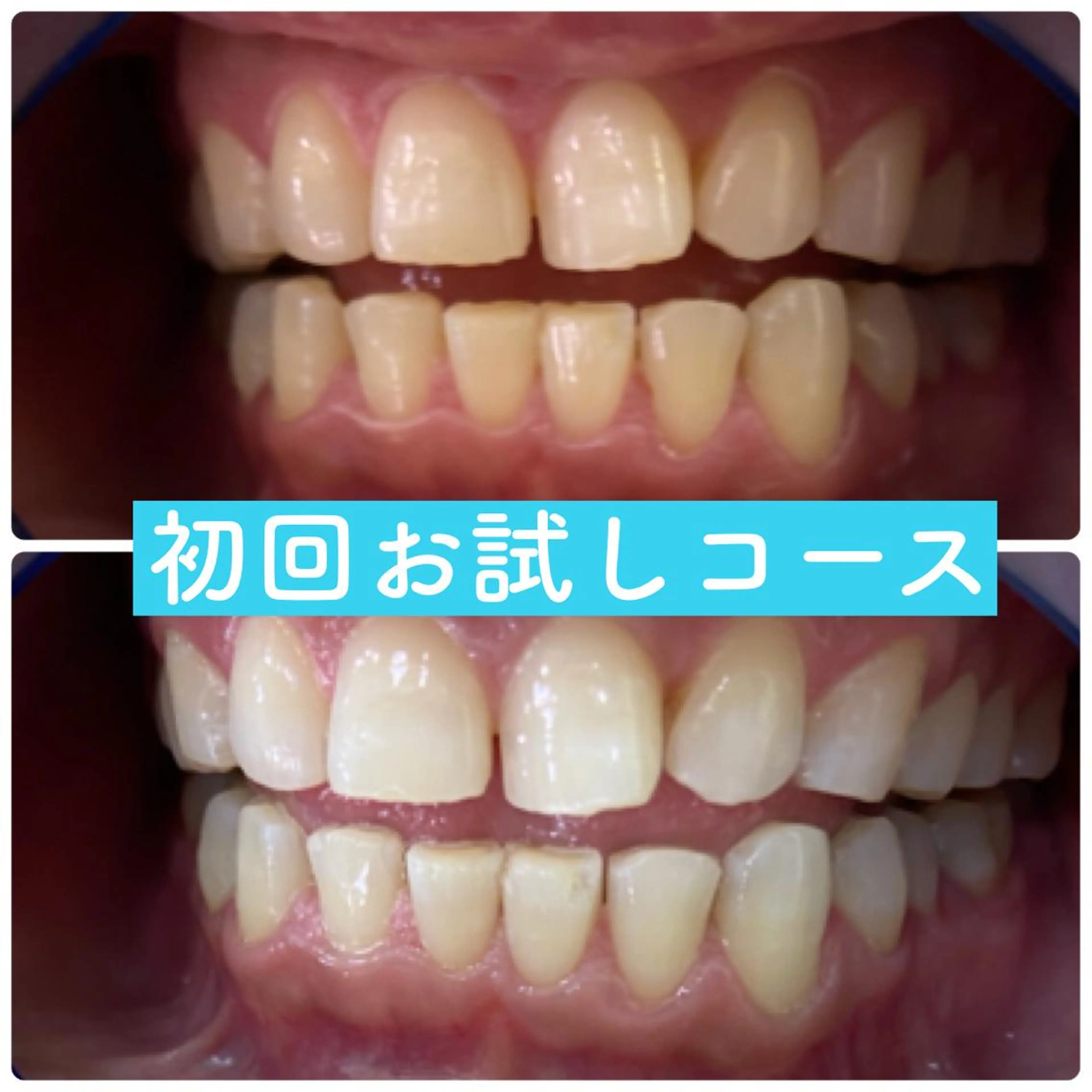 ホワイトニングルーム 横浜店のその他イメージ