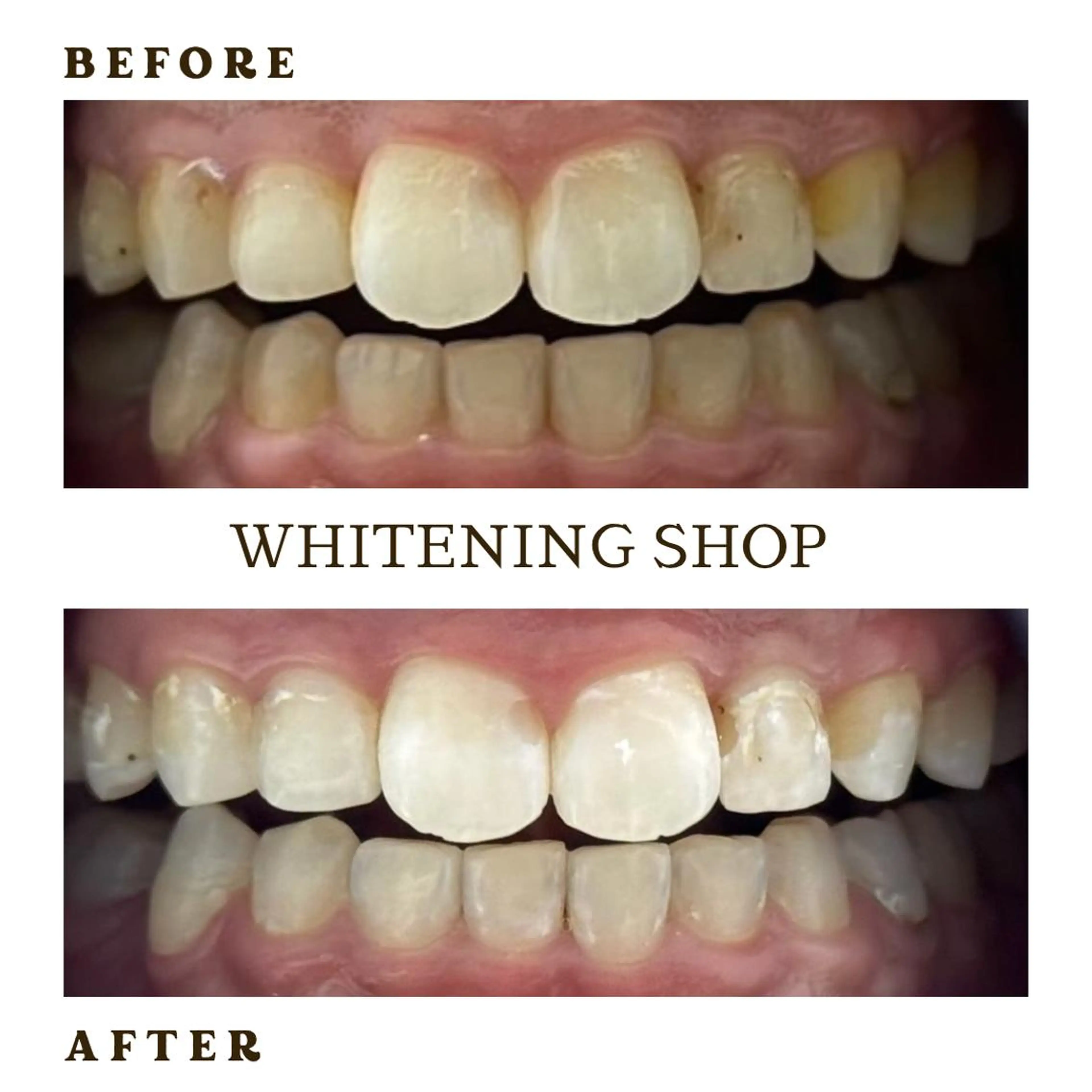 メンズ その他 ホワイトニング ショップ葛西店のその他イメージ