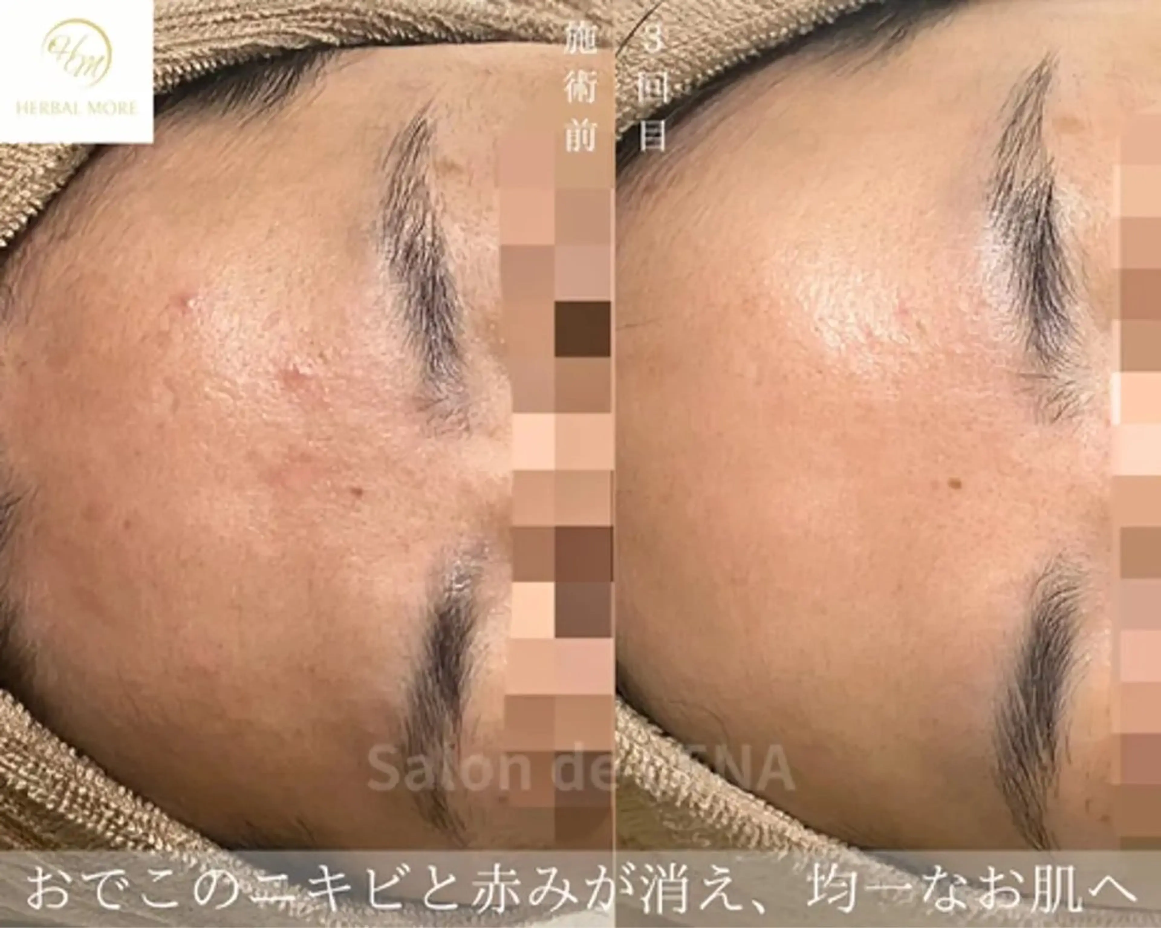 ハーブピーリング専門 グランディール　武内のエステ・リラクイメージ