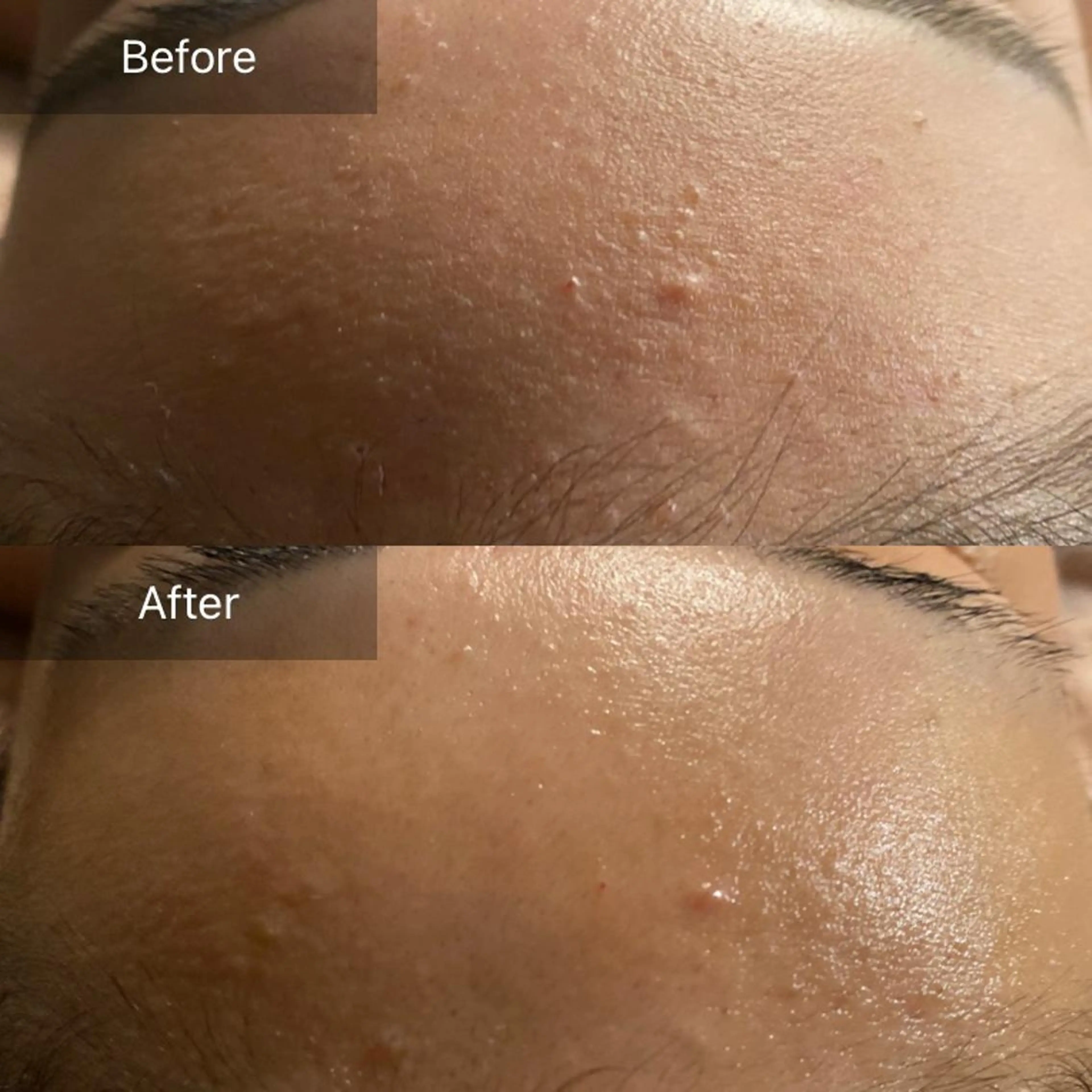 Mandarin Orange所属・毛穴から始める肌メン テマンダリンオレンジのエステ・リラクイメージ