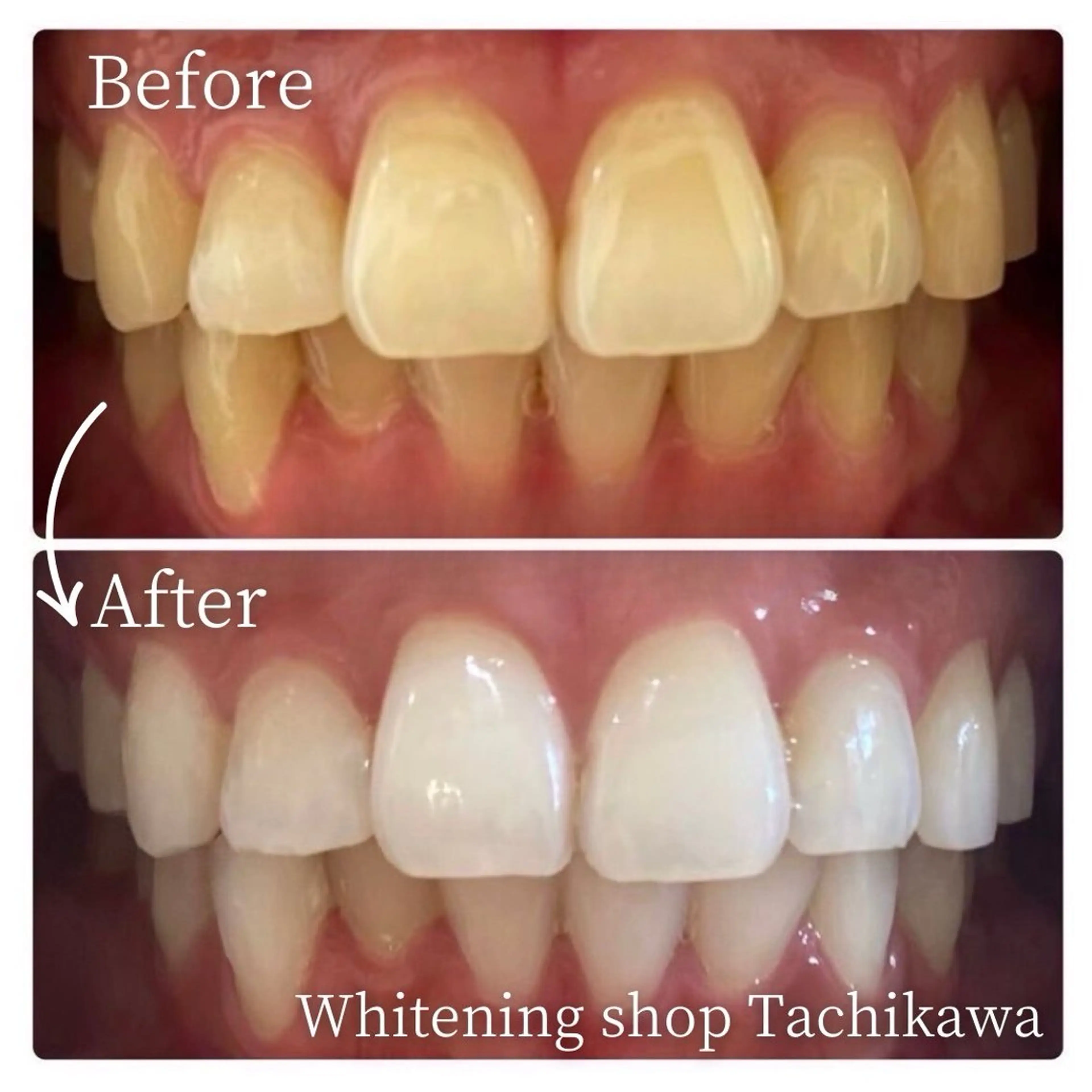 セルフ　ホワイト ニングショップ立川のその他イメージ