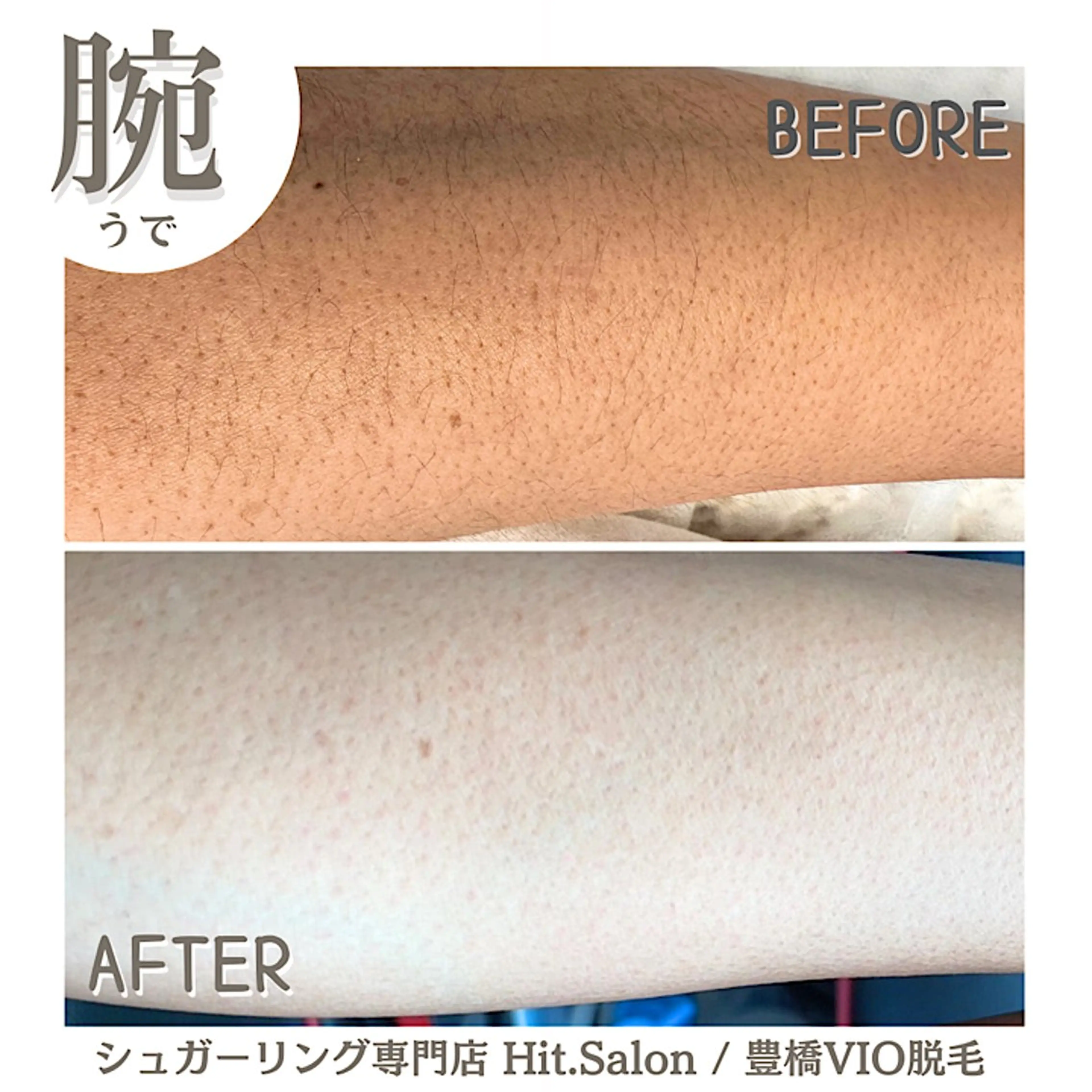 Hitomi シュガーリング豊橋のその他イメージ