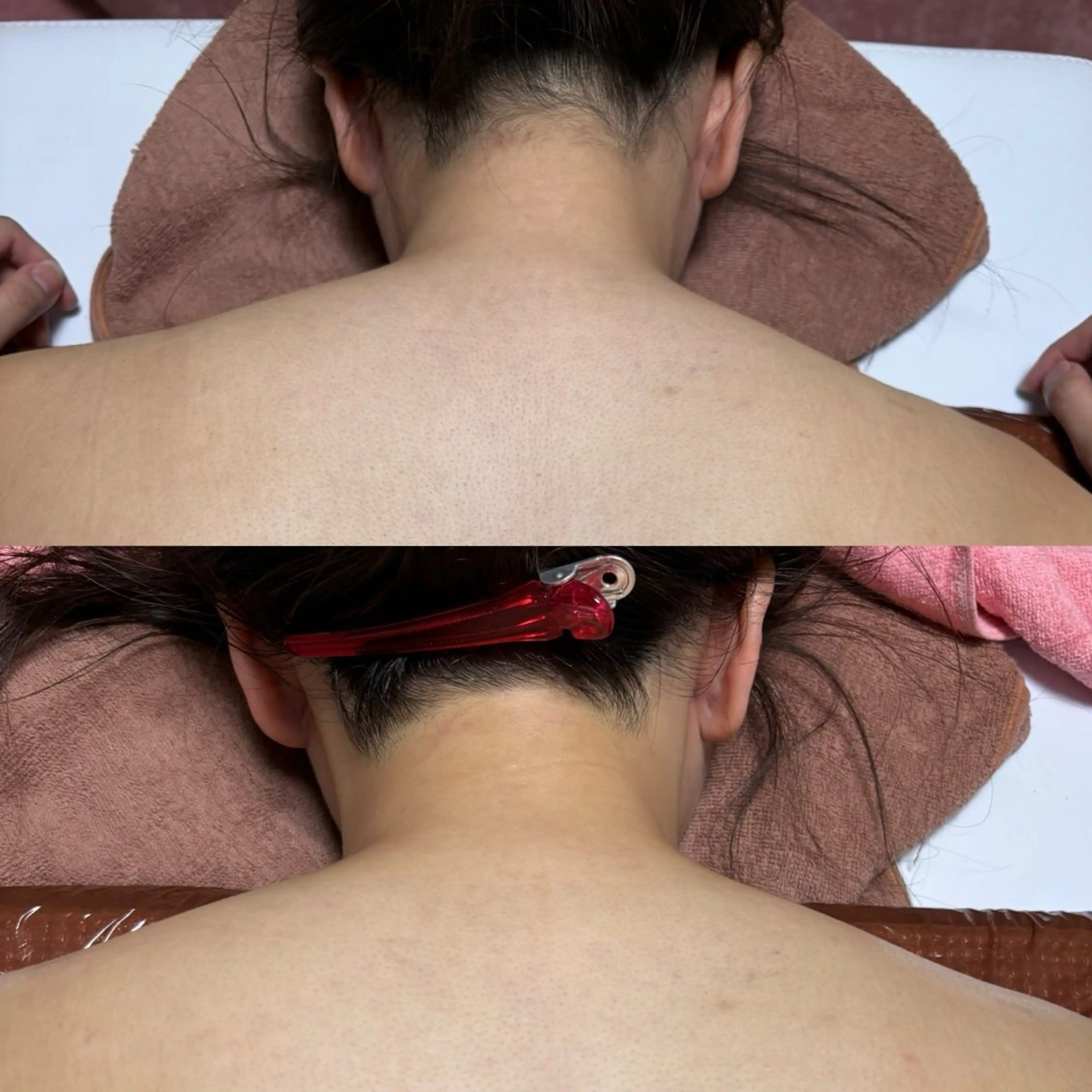 Linomalie エステ/たるみ/脱毛のエステ・リラクイメージ